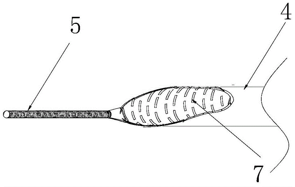 Auxiliary catheter for guiding intravascular stent delivery