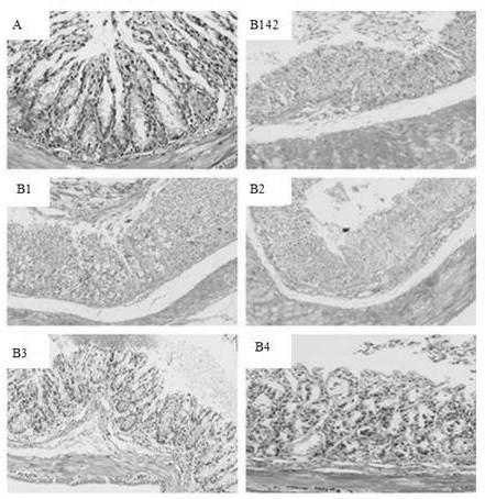 A pig-derived glp-2 recombinant plantarum lactobacillus with site-specific transformation and its preparation method and application