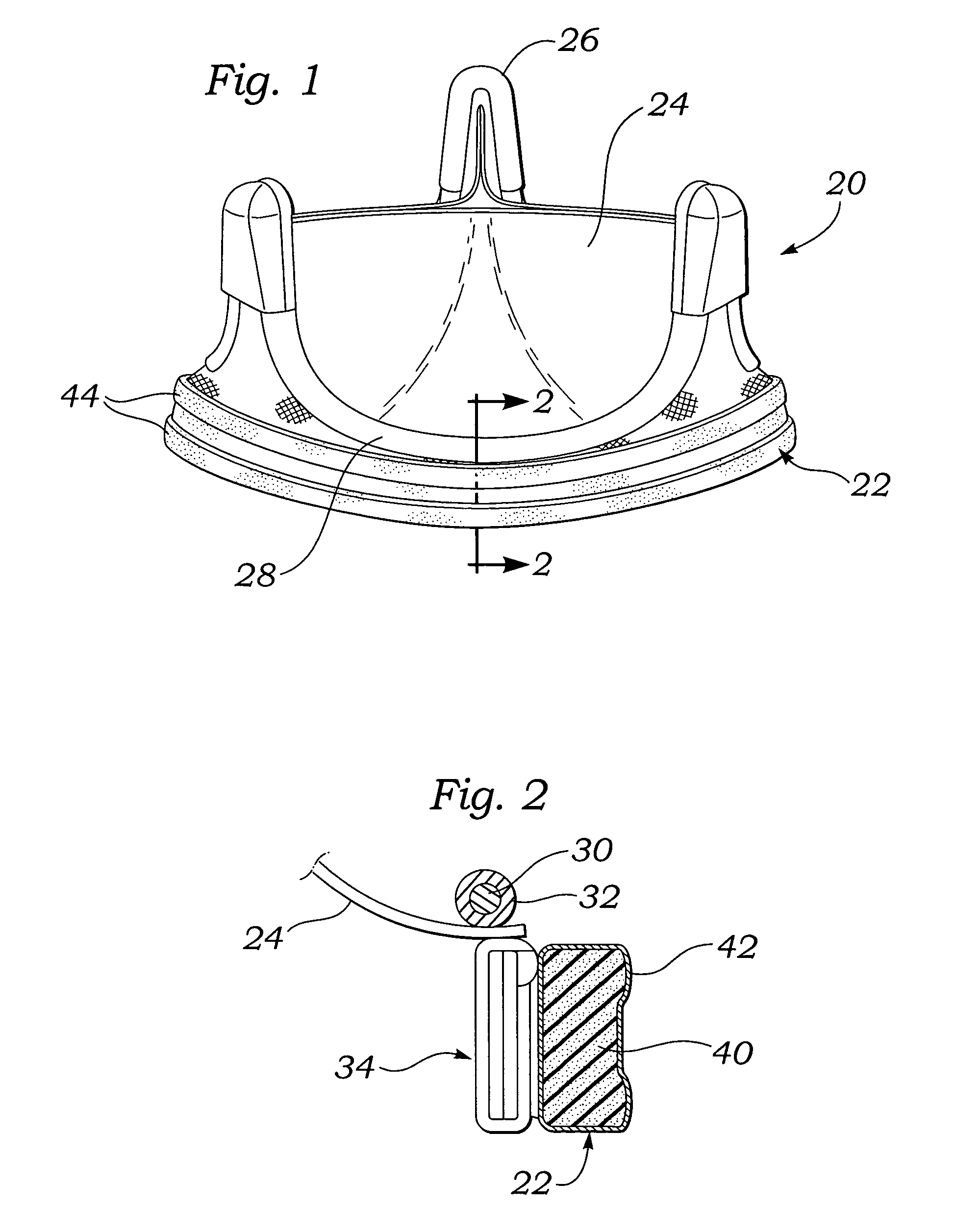 Sutureless heart valve attachment