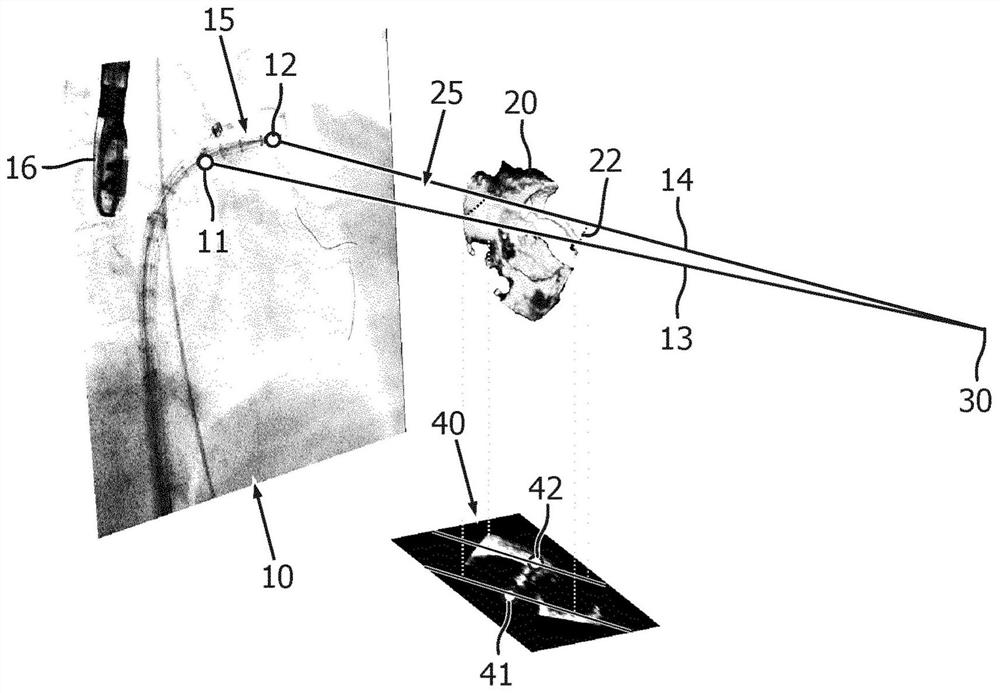 Image-based device tracking