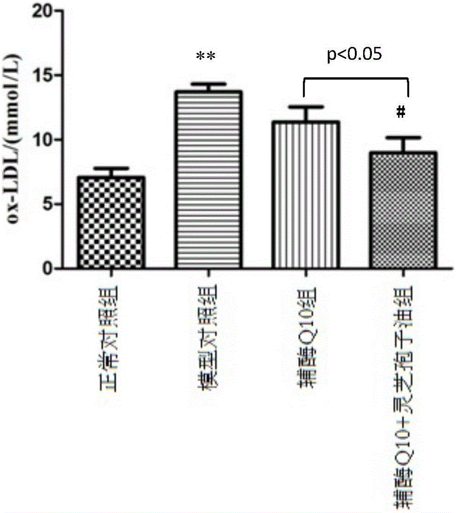 Application of coenzyme Q10 combined ganoderma lucidum spore oil in preparation of antiatherosclerotic drugs