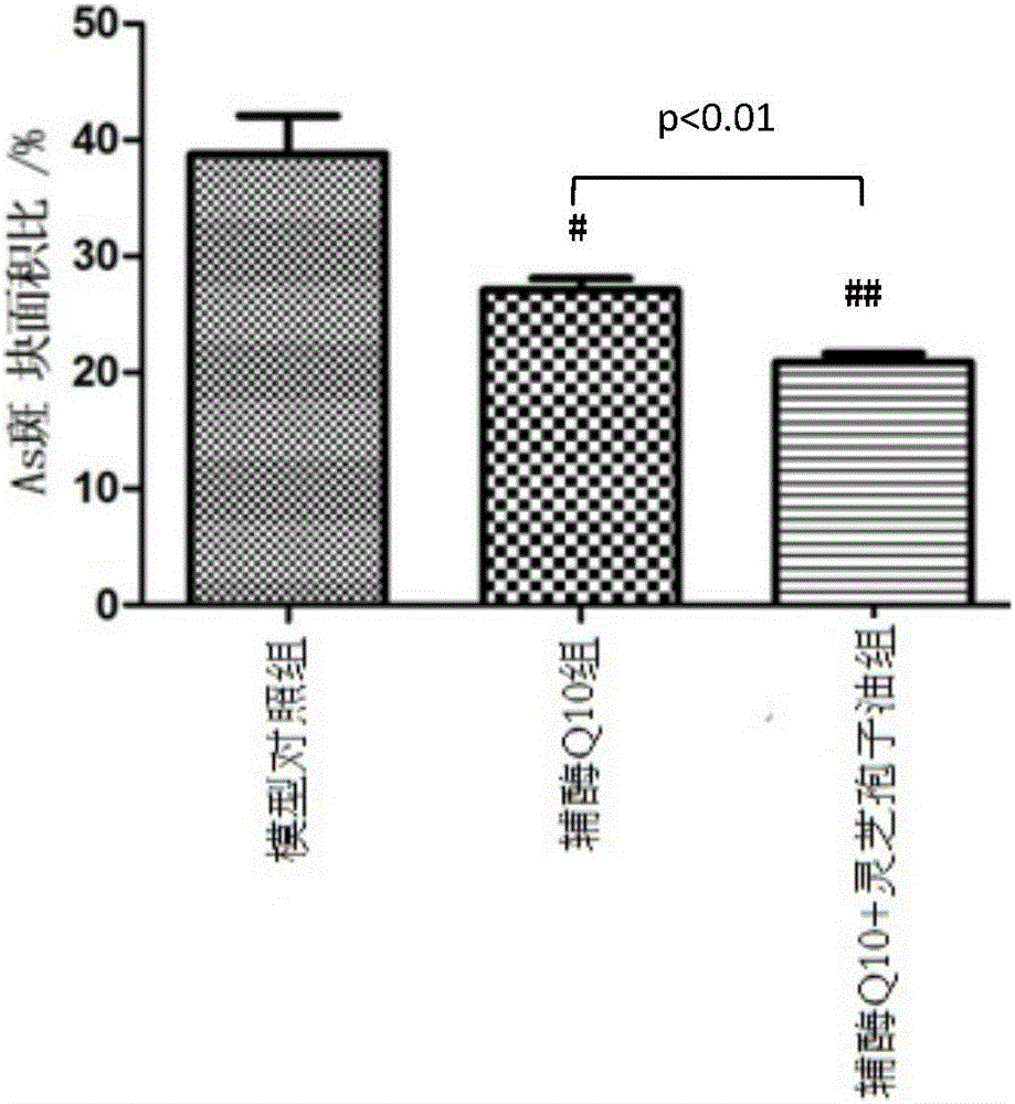 Application of coenzyme Q10 combined ganoderma lucidum spore oil in preparation of antiatherosclerotic drugs