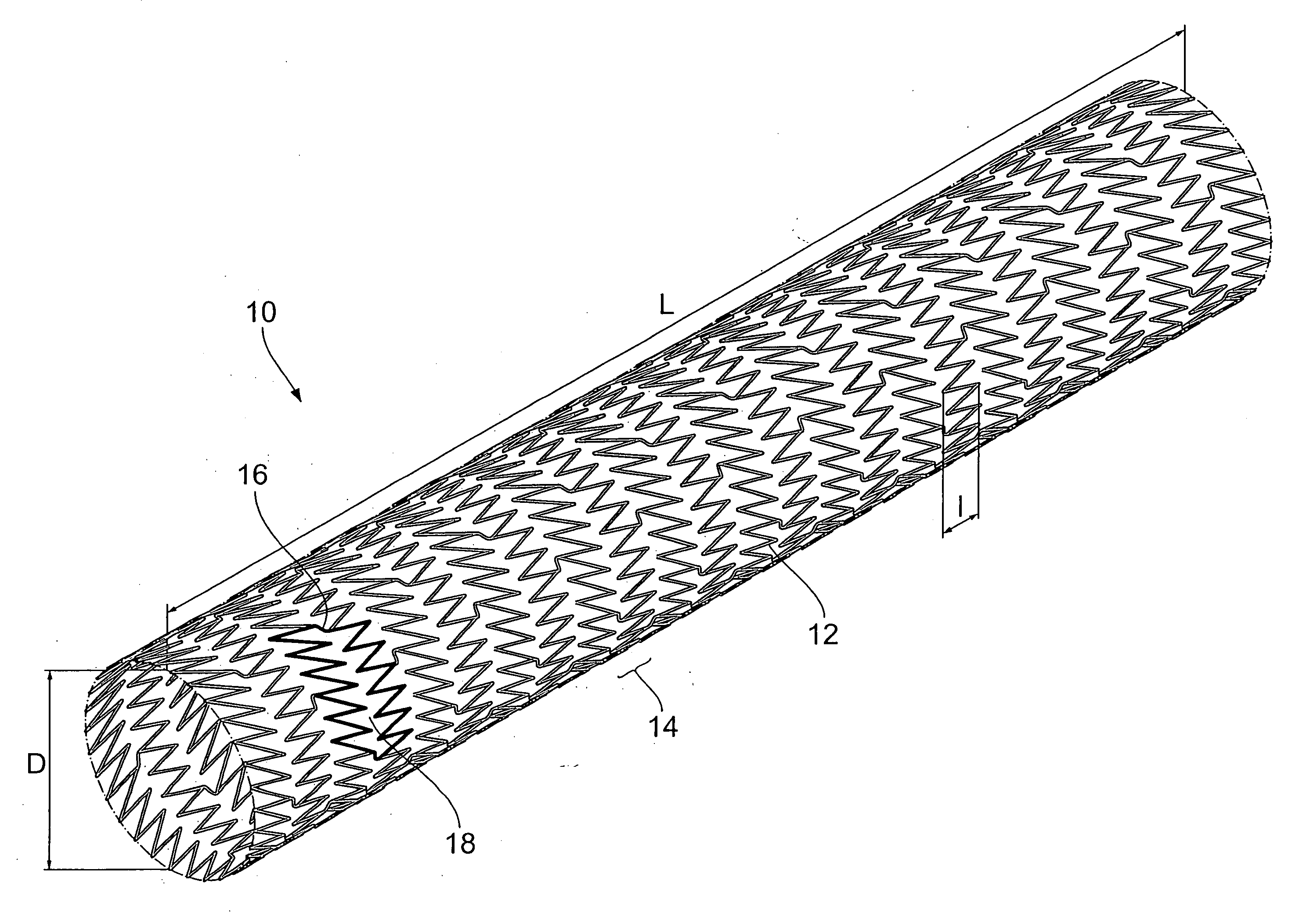 Endoprosthesis comprising a magnesium alloy