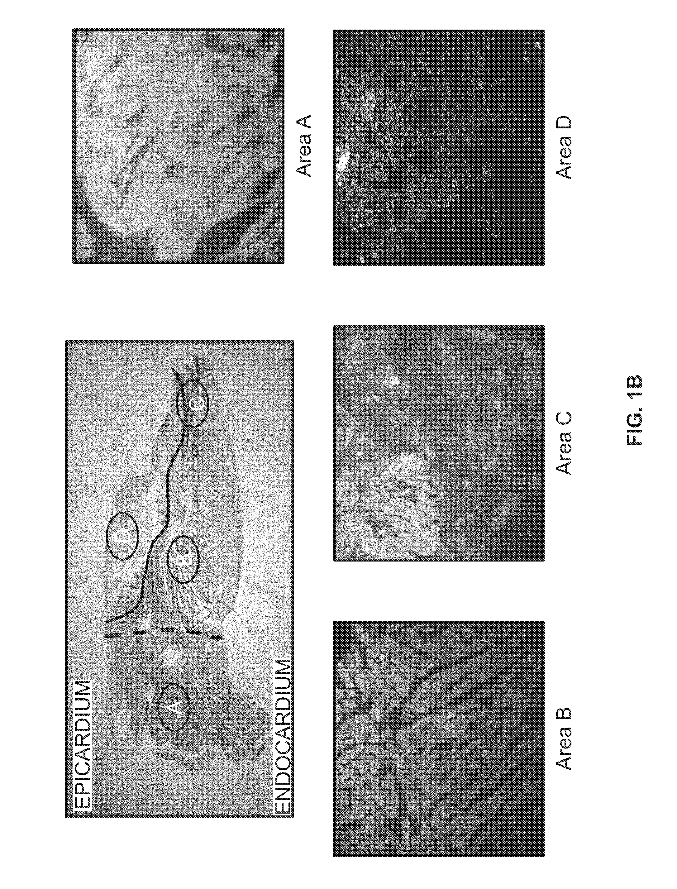 Use of human stem cells and/or factors they produce to promote adult mammalian cardiac repair through cardiomyocyte cell division