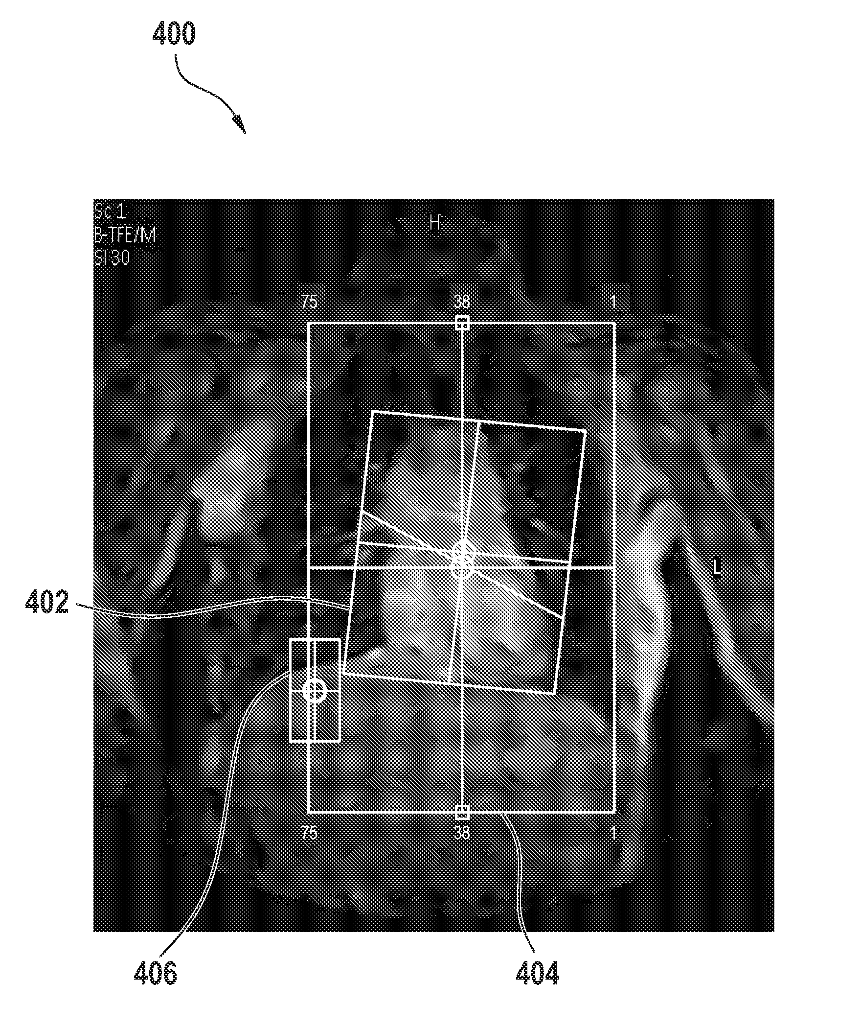 Automated sequential planning of MR scans