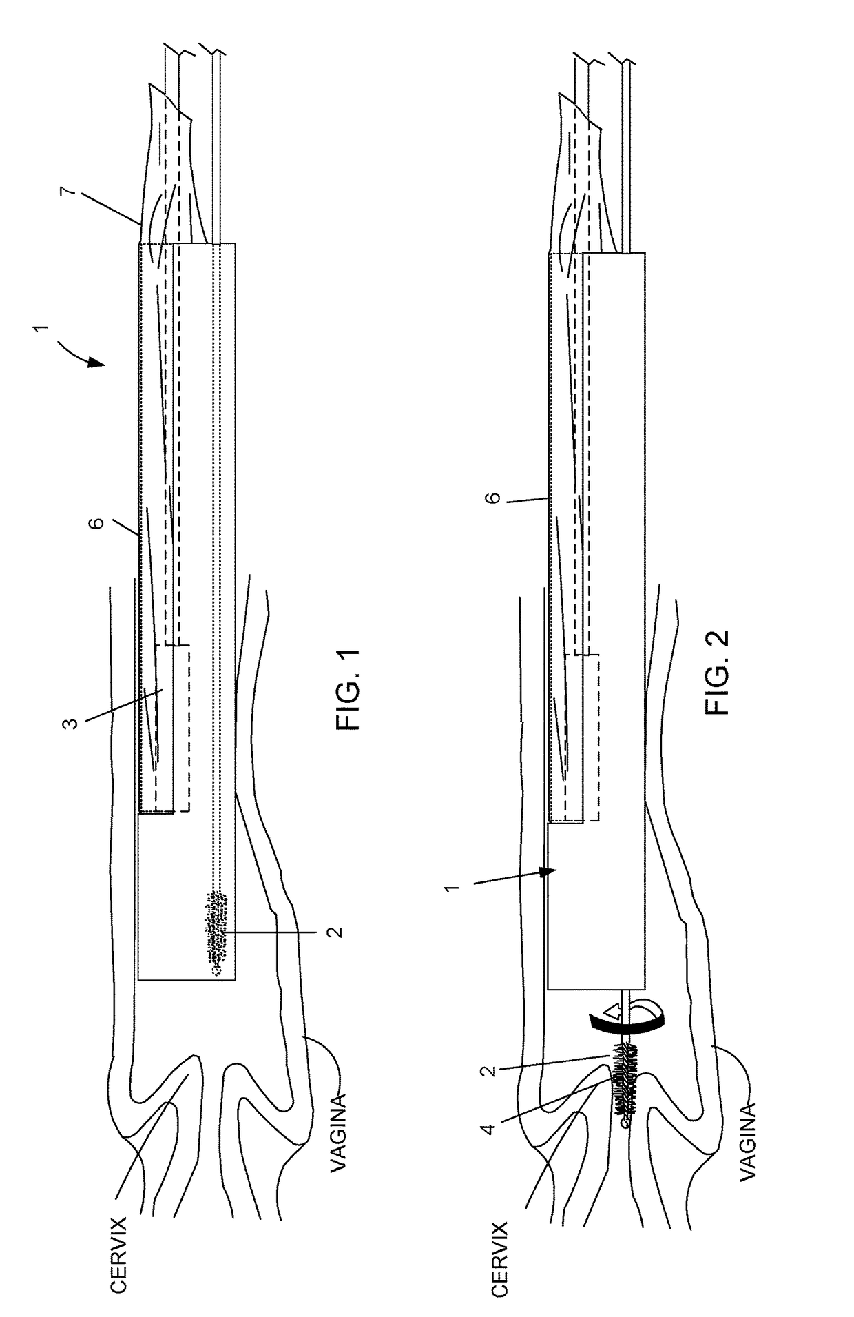 Device and method for conducting a pap smear test