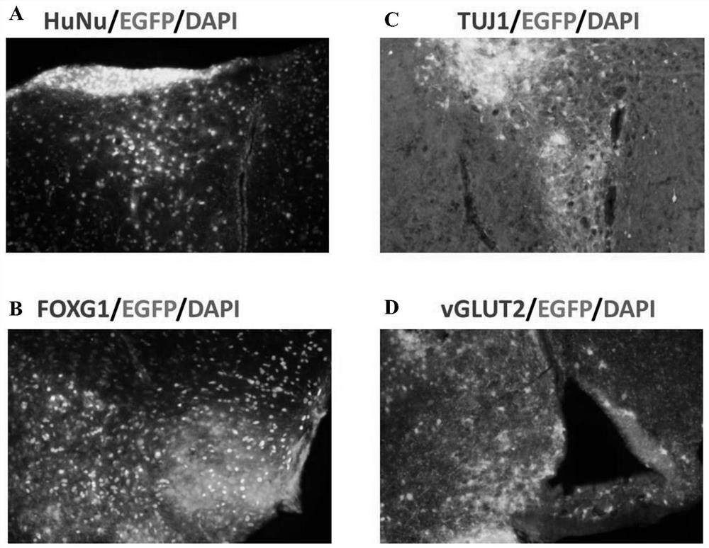 In-vitro induction and long-term culture system, induced culture method and application of forebrain neural stem cells