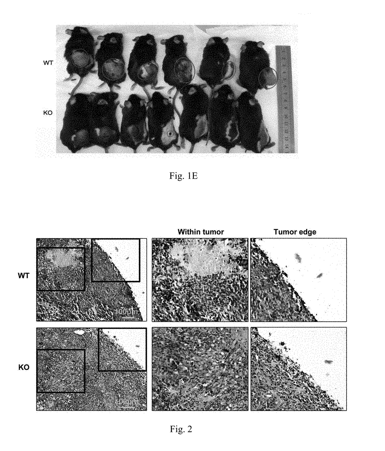 Fats as a target for treating tumors and uses thereof