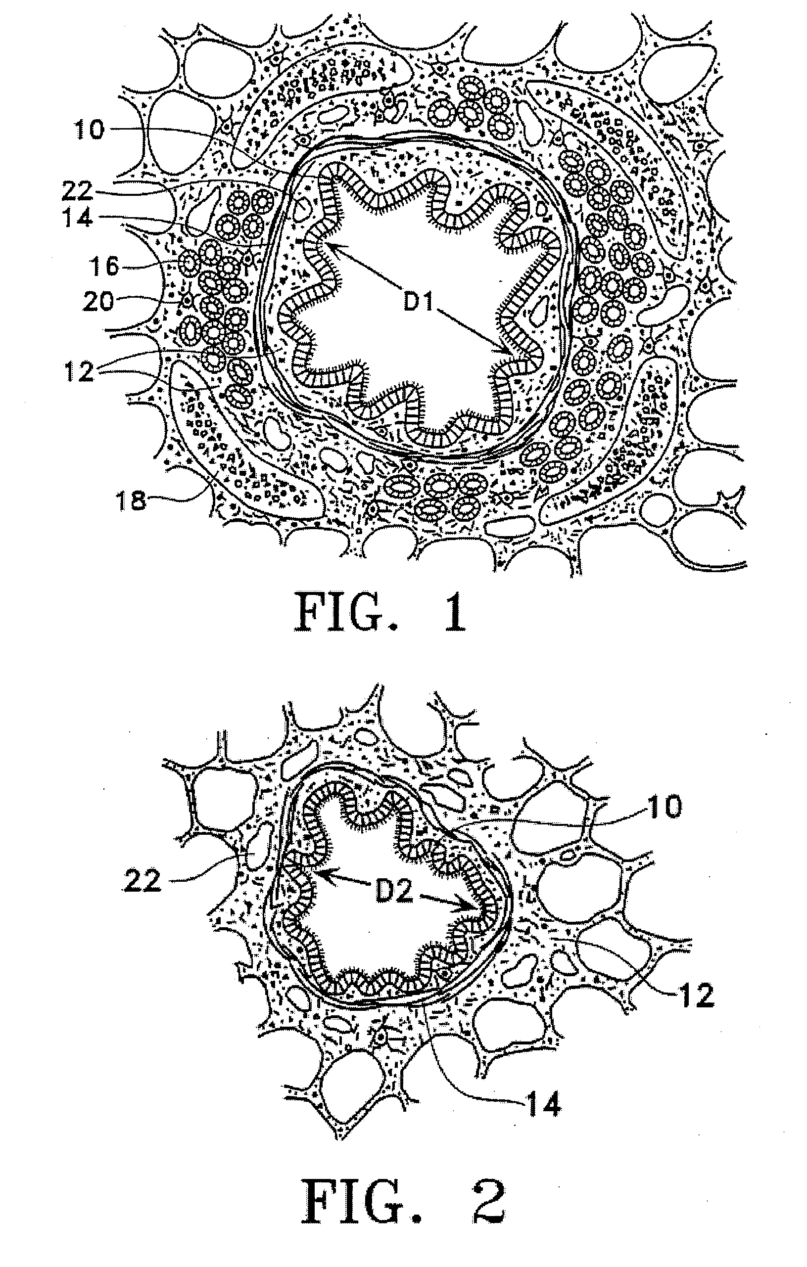 Methods of reducing mucus in airways