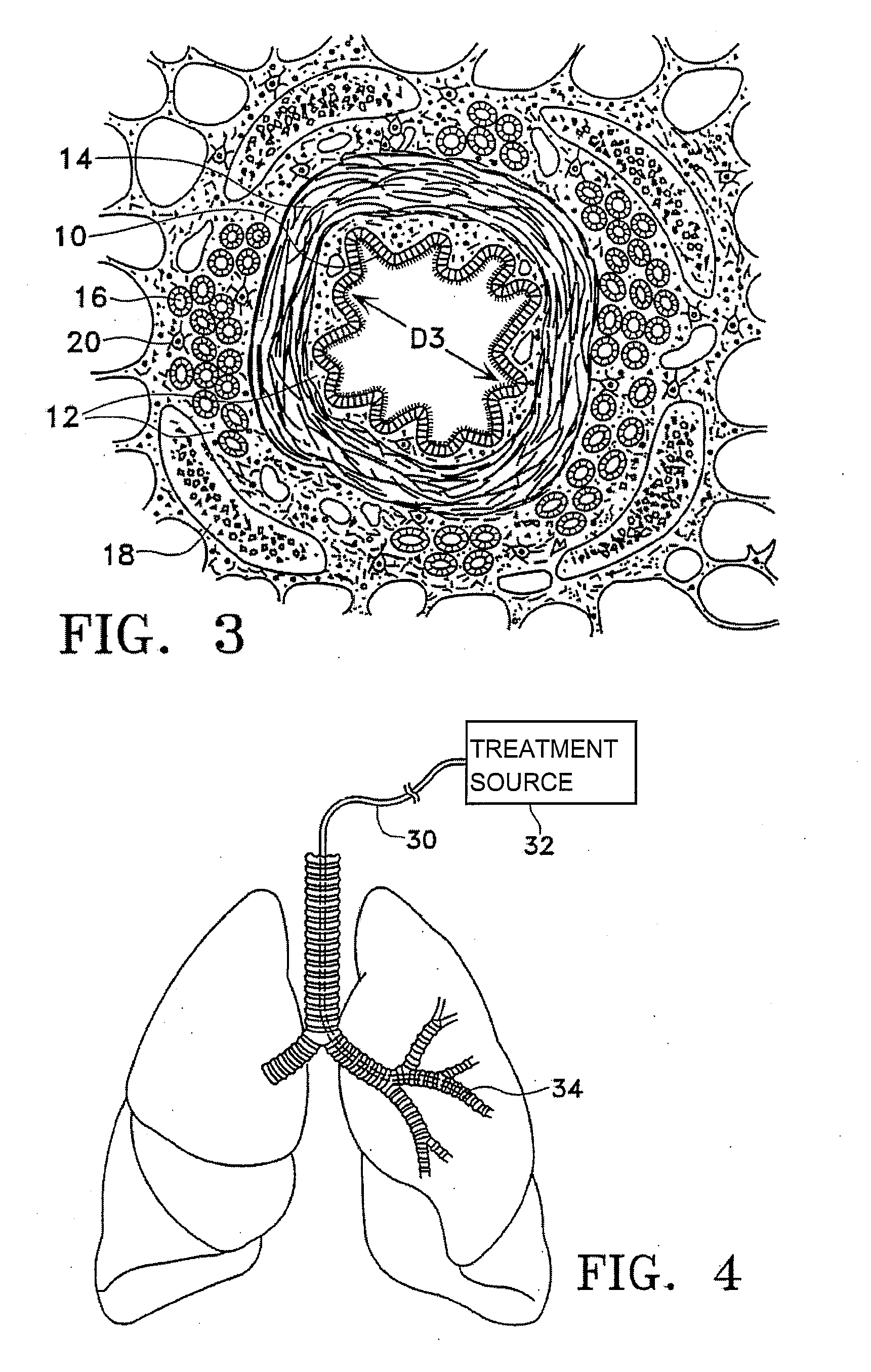 Methods of reducing mucus in airways