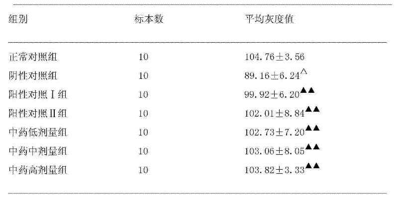 Traditional Chinese medicine composition and preparation method thereof