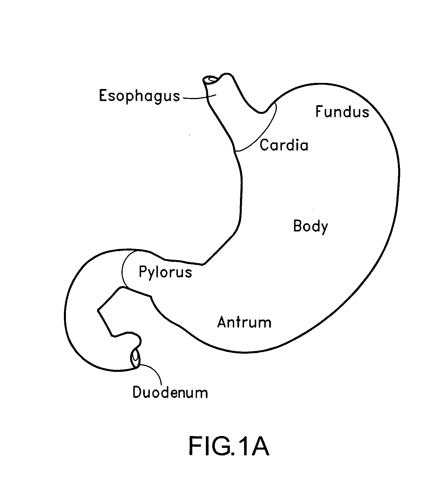 Apparatus and method for treating obesity using neurotoxins in conjunction with bariatric procedures