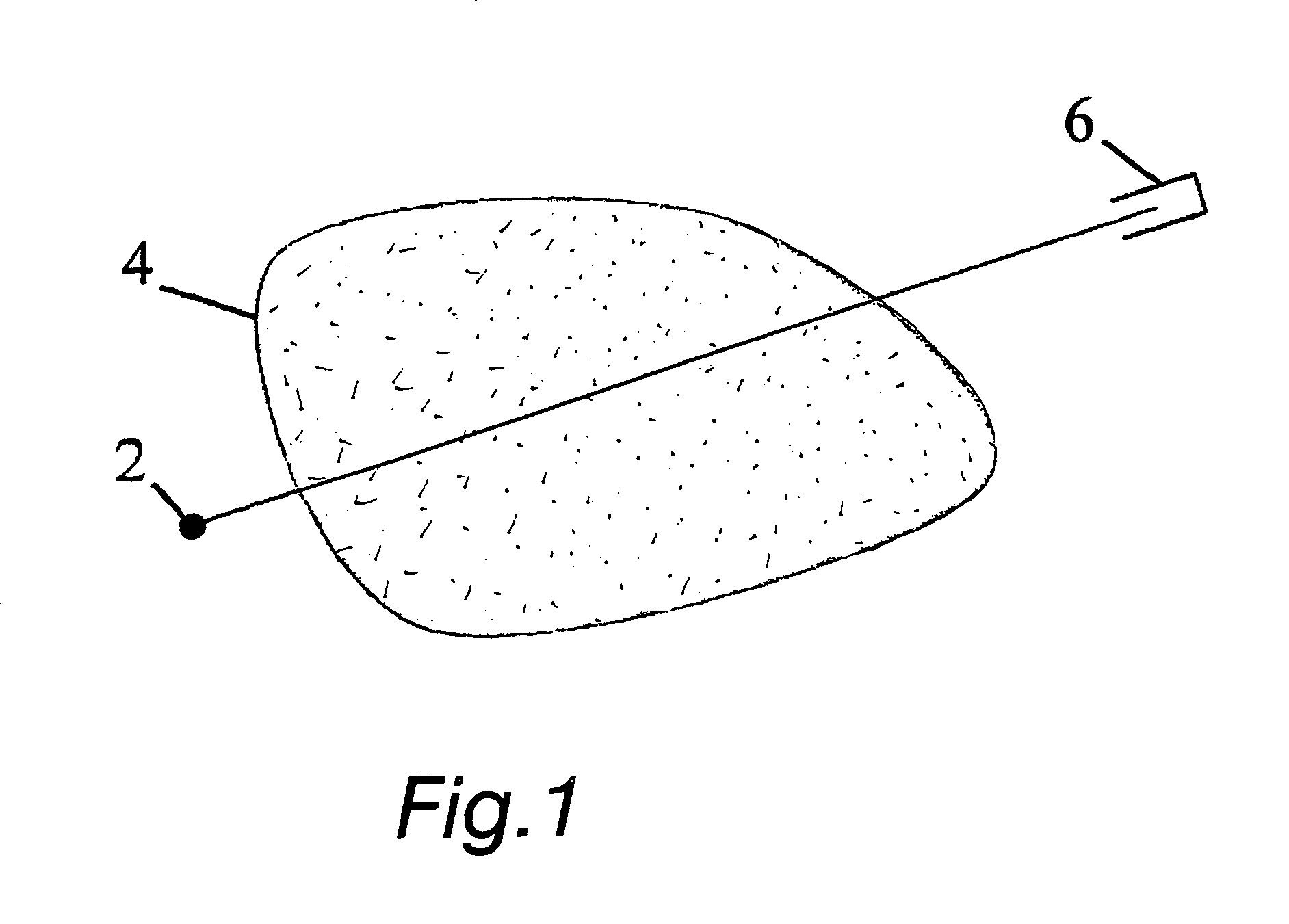 Method and arrangement for medical X-ray imaging