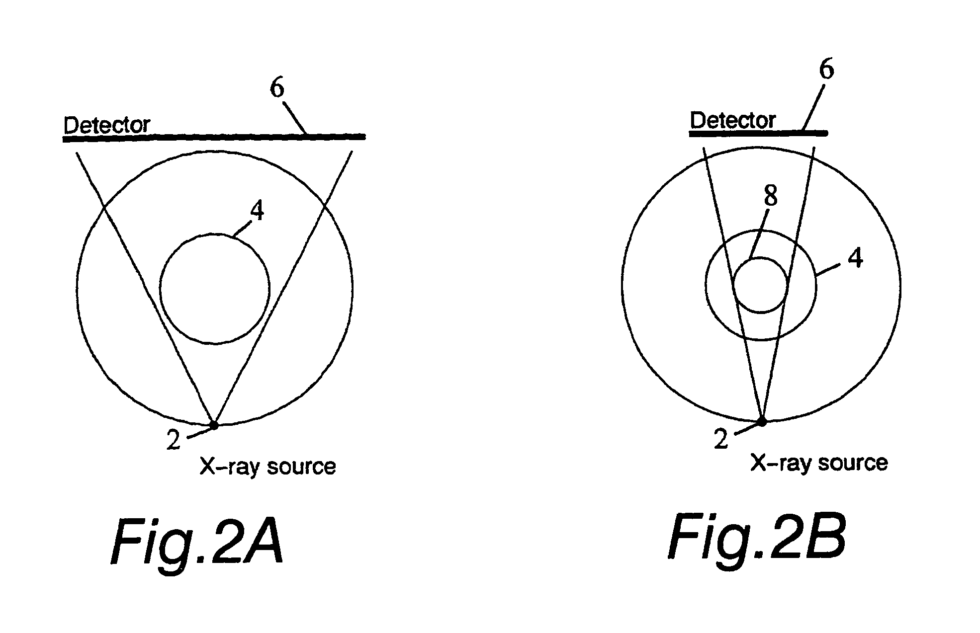 Method and arrangement for medical X-ray imaging