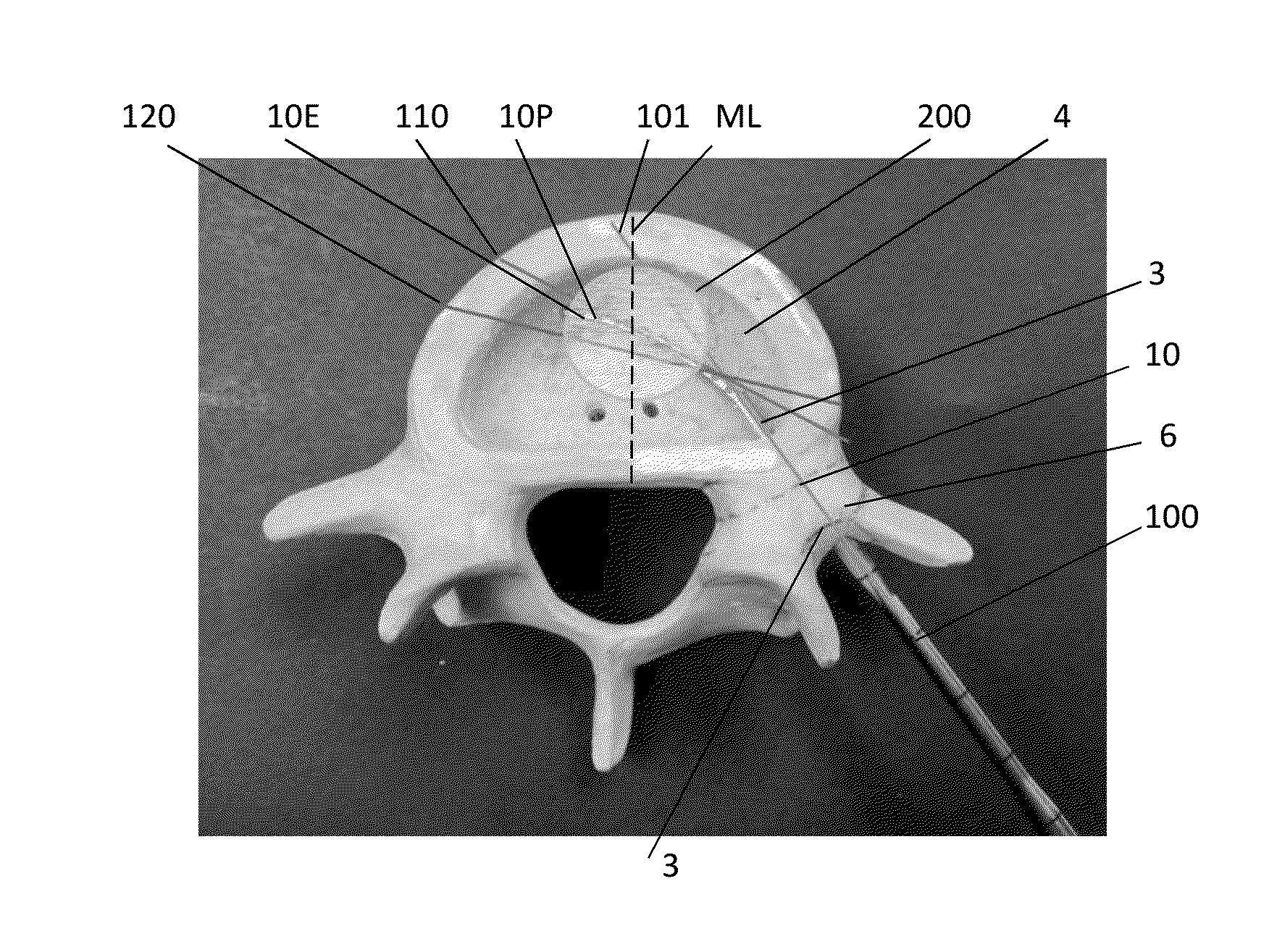 Tunneling device