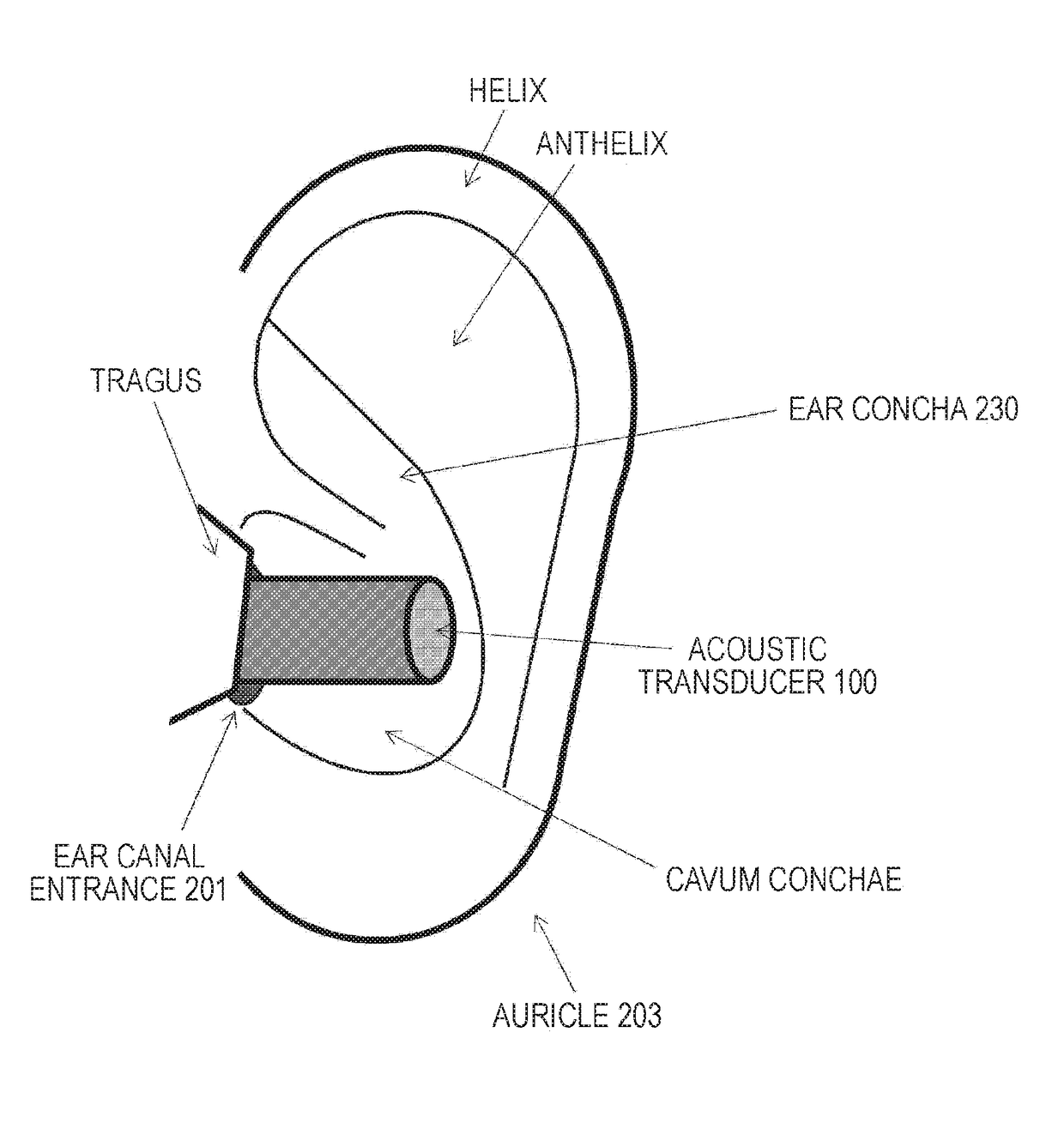 Acoustic transducer