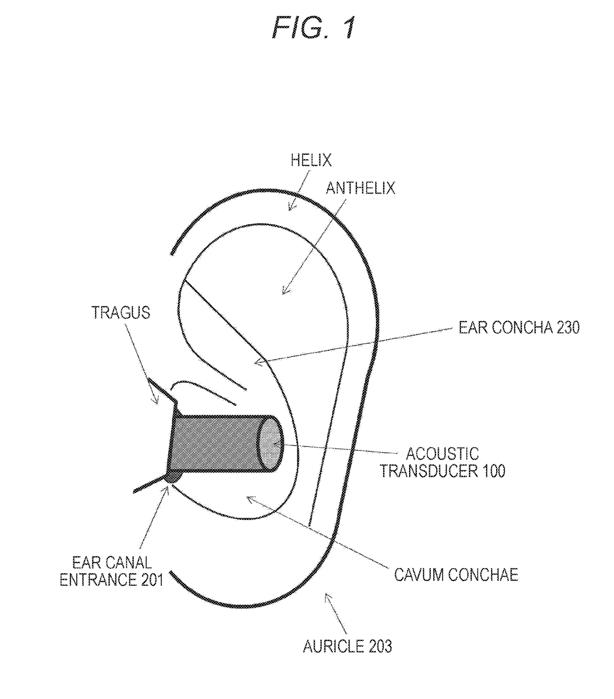 Acoustic transducer