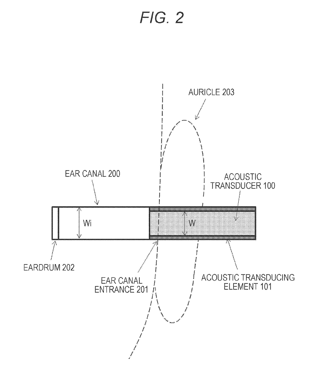 Acoustic transducer