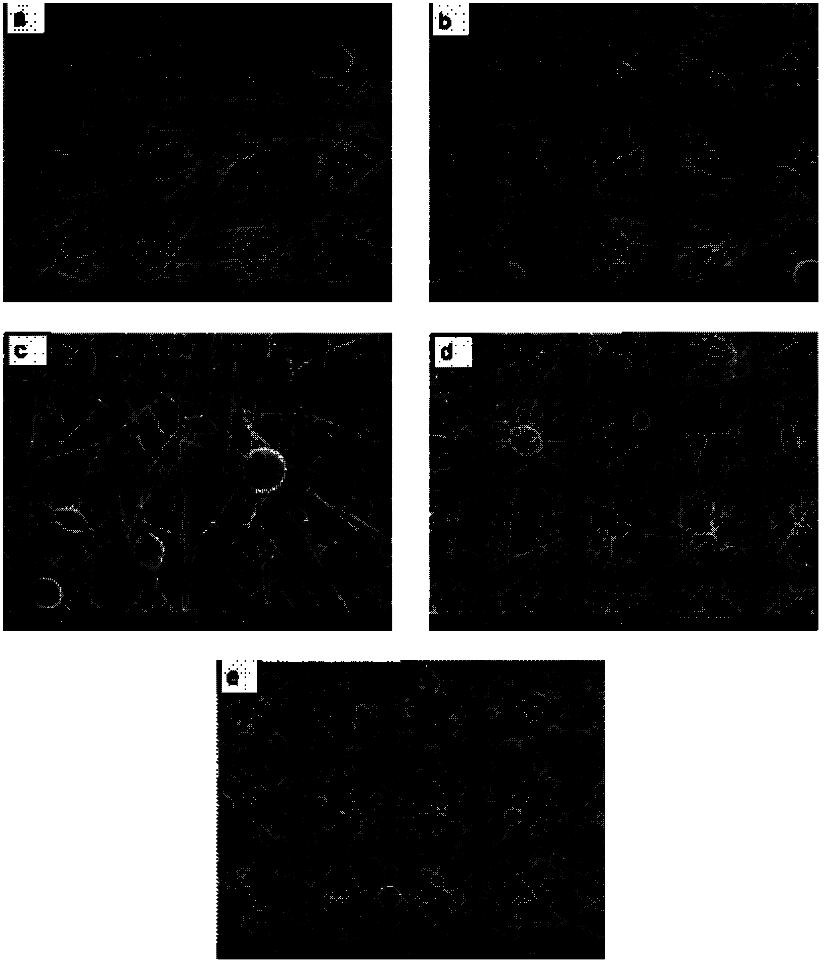 Composite nano fiber support material, as well as preparation method and application in bone repairing aspect