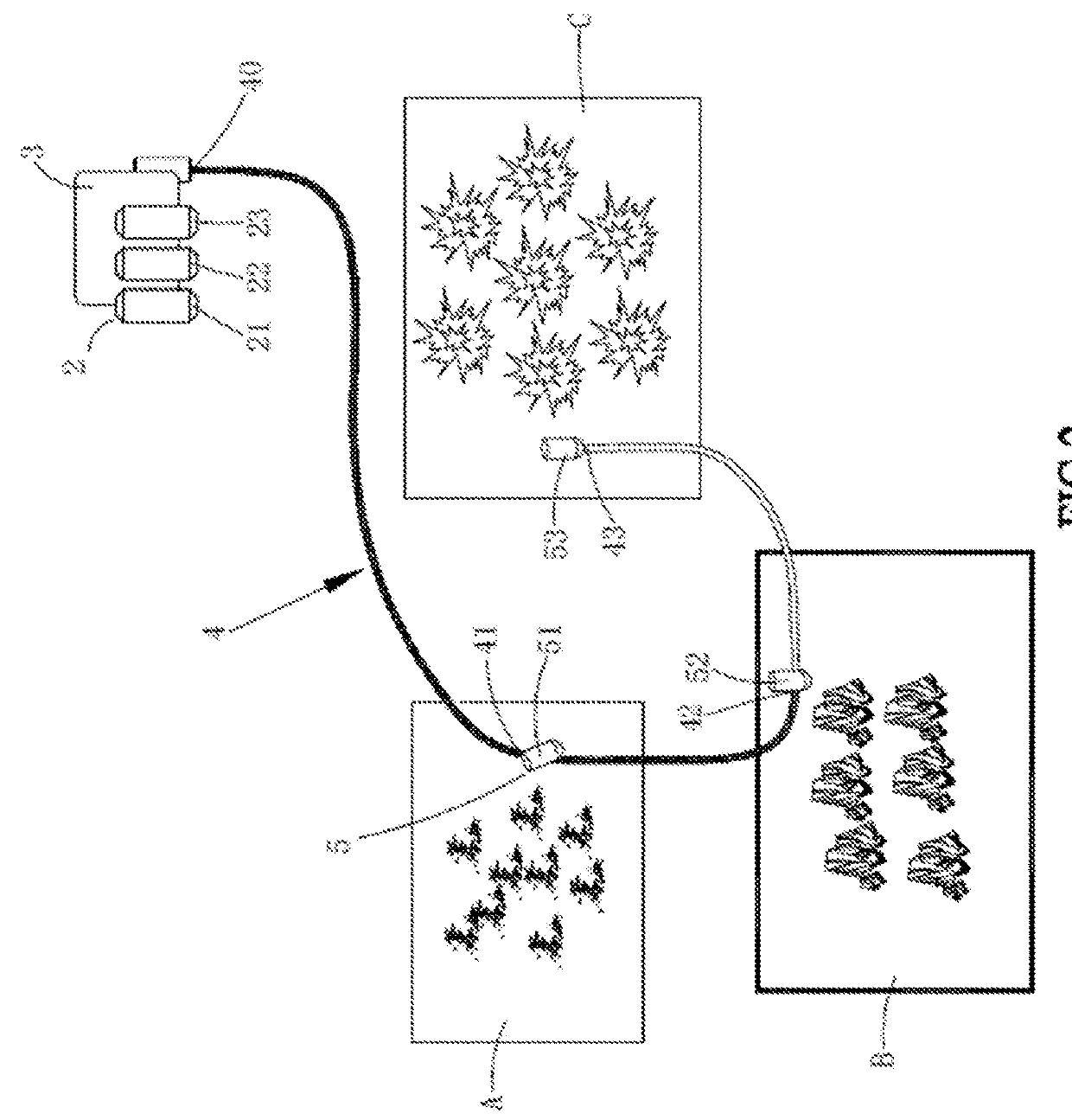 Irrigation System