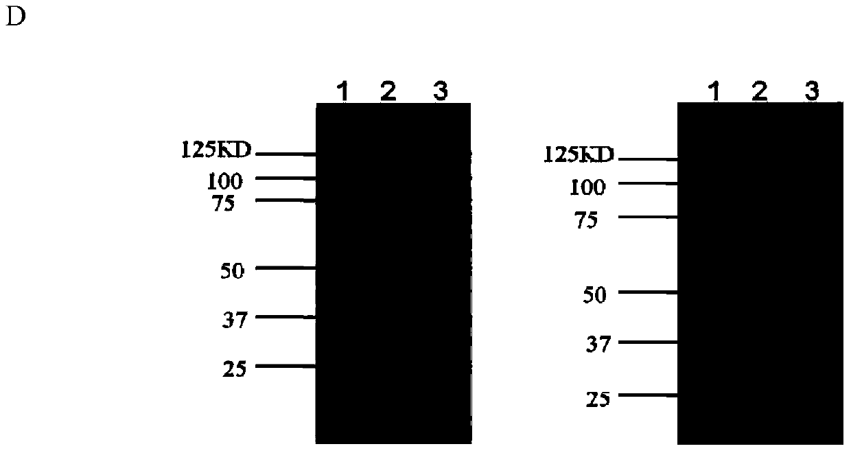 A bivalent anthrax vaccine