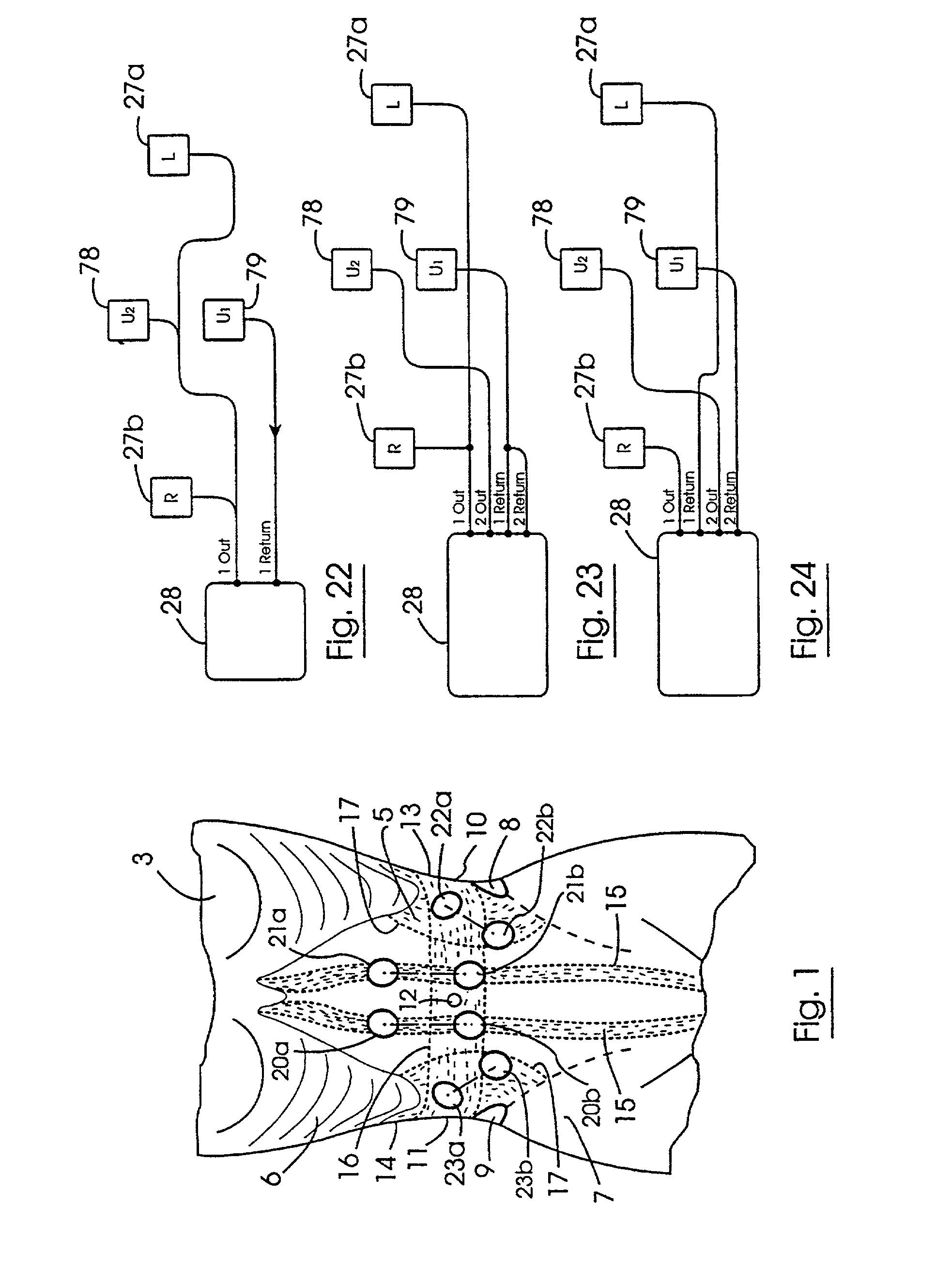 Abdominal belt with adjustable electrodes