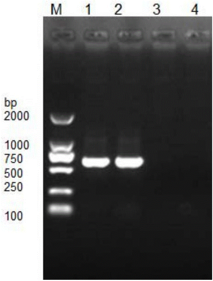 LAMP detection primers suitable for bombyx mori egg microsporidia and quick detection method thereof