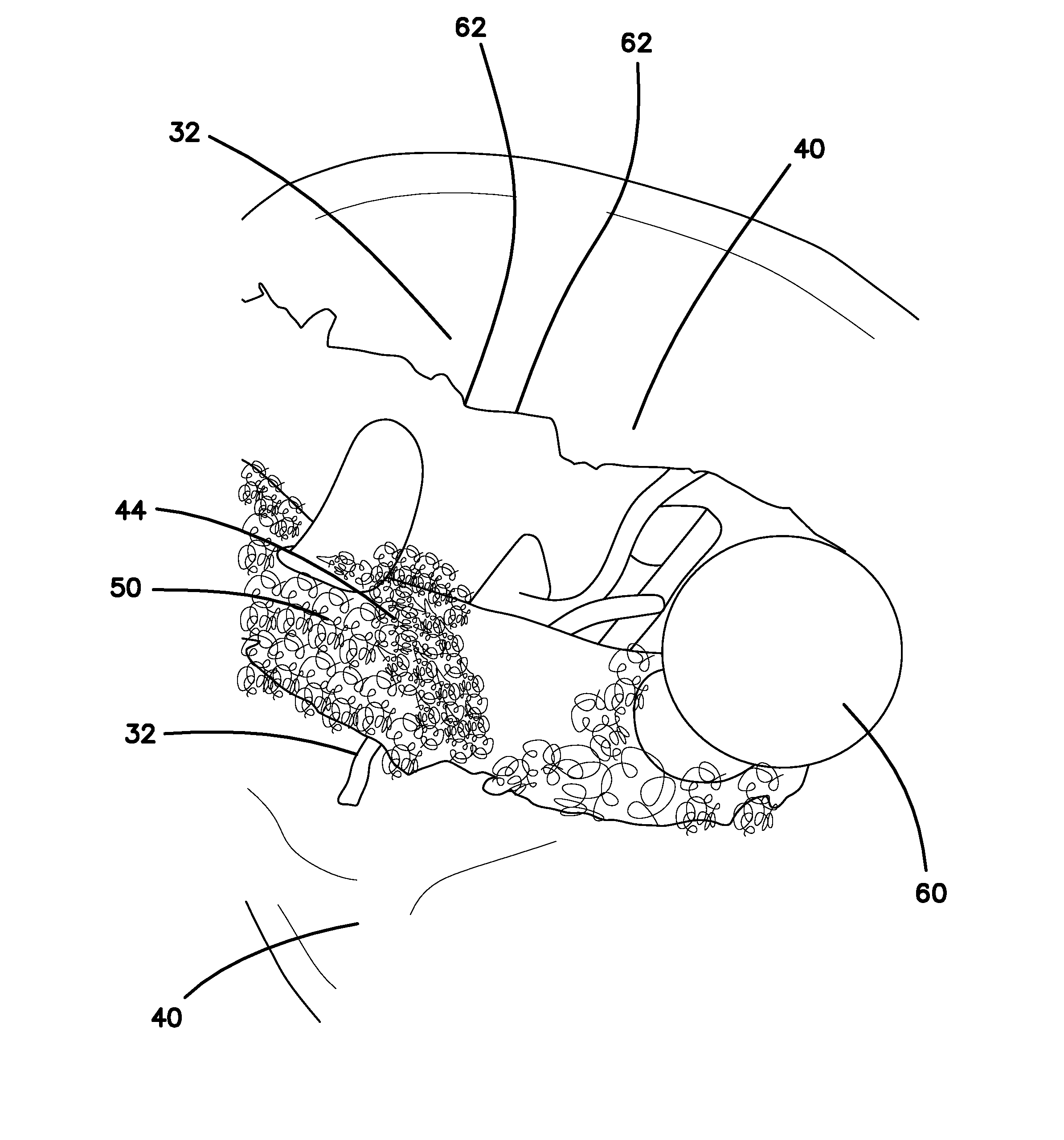 Simulated dissectible tissue