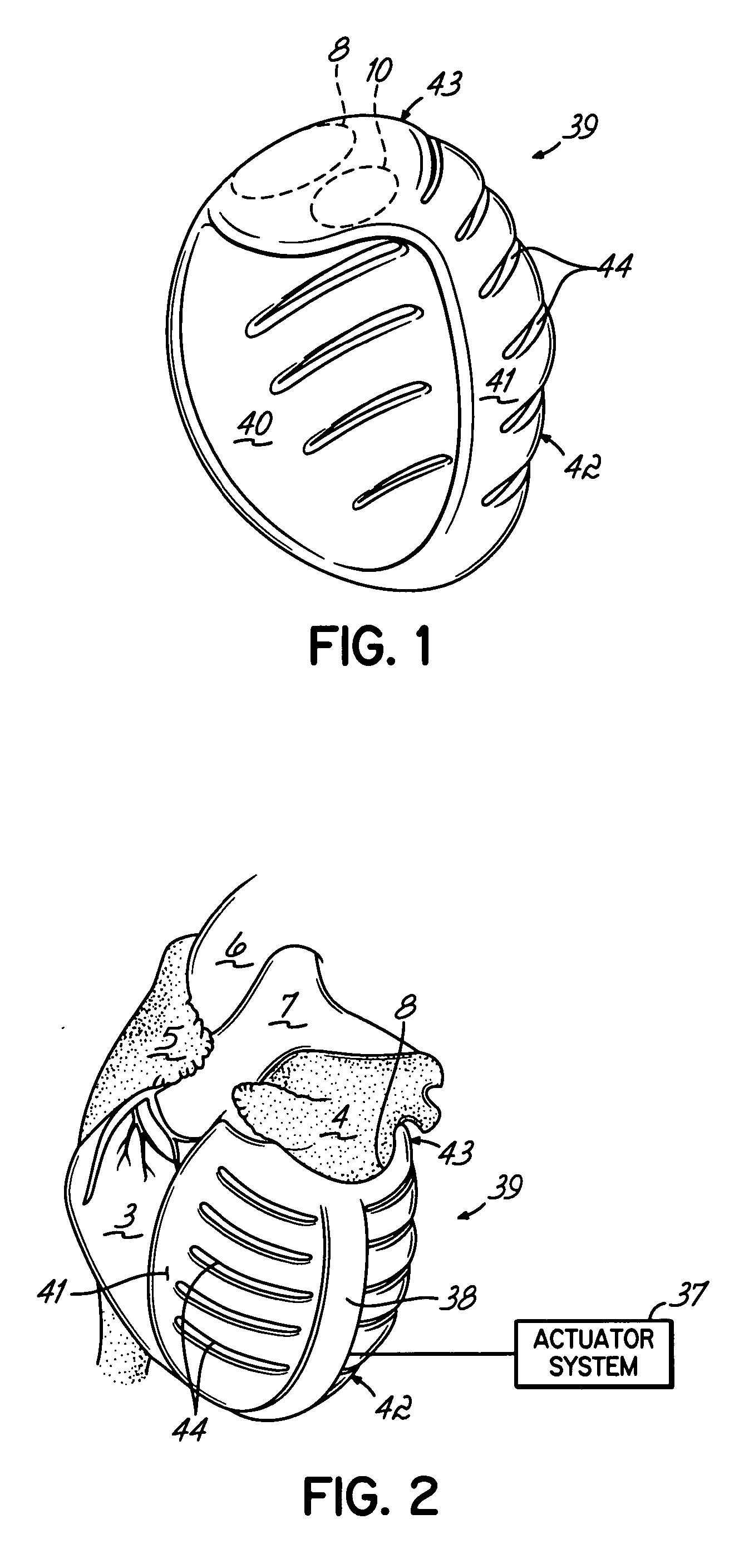 Deforming jacket for a heart actuation device