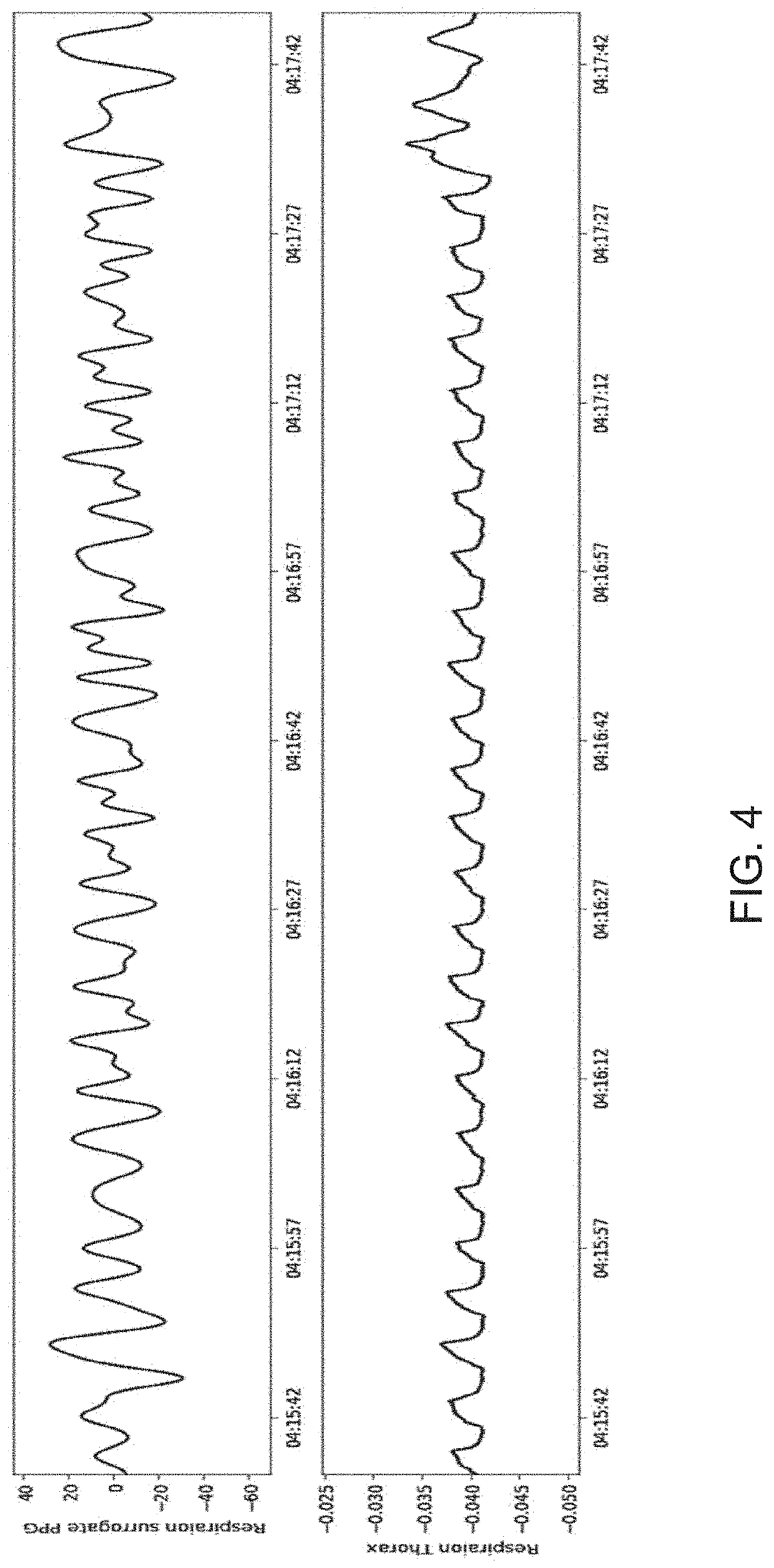 Sleep apena detection system and method