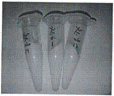 Ointment for treating leucoderma by combination of fluoxetine and traditional Chinese medicine component as well as preparation method thereof