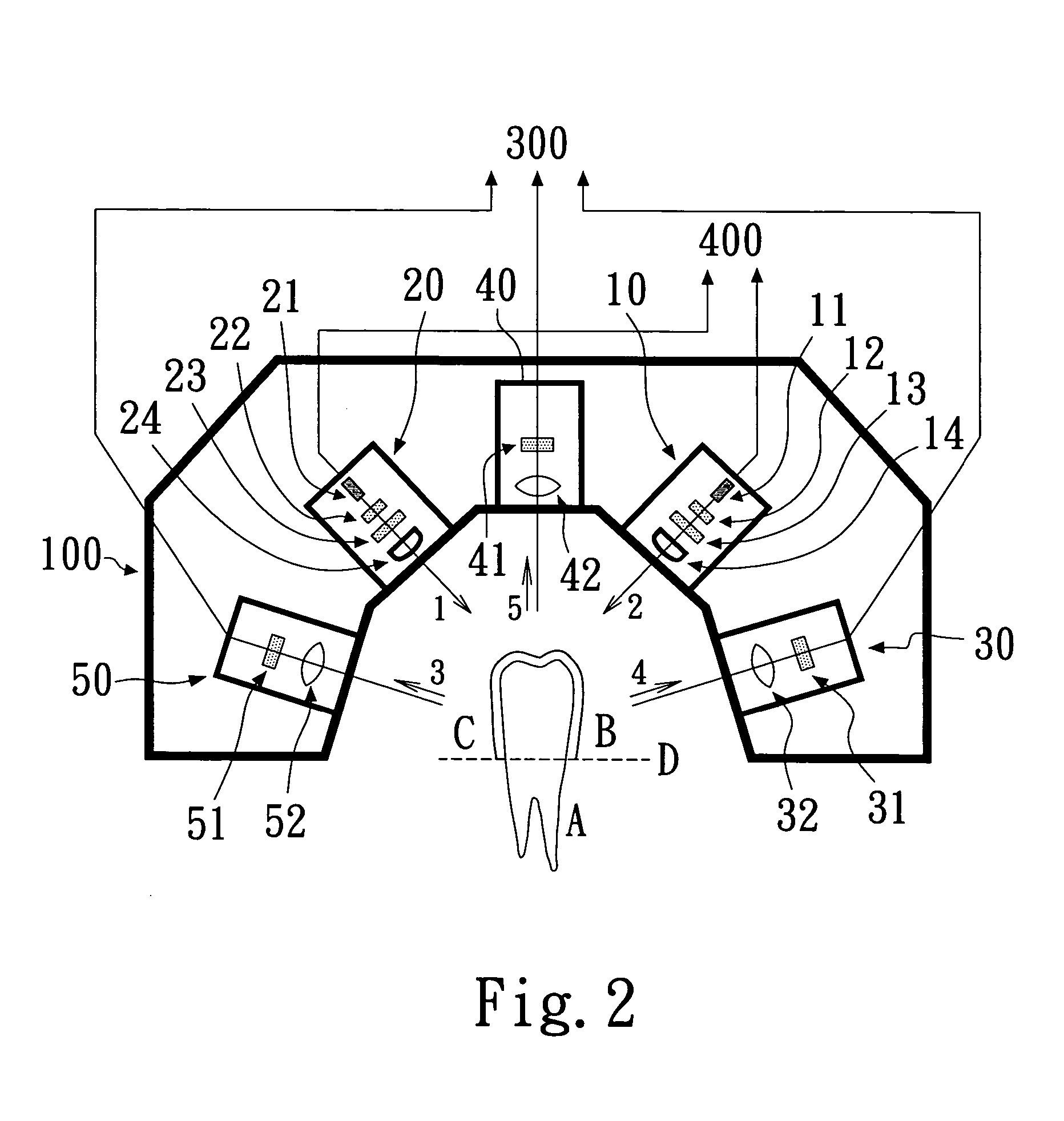 Apparatus and method for rapid and precise scanning of three-dimensional occlusal profile of dental cast