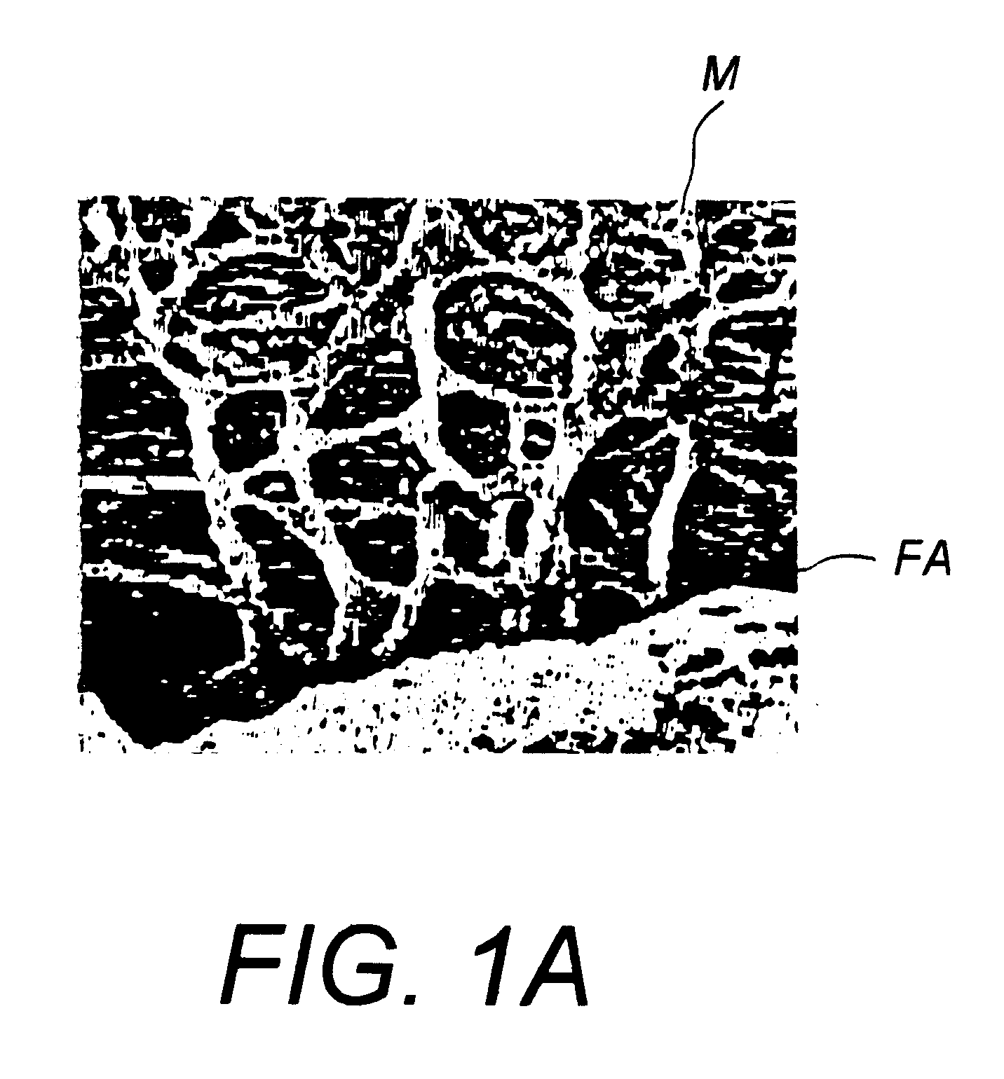 Devices and techniques for light-mediated stimulation of trabecular meshwork in glaucoma therapy