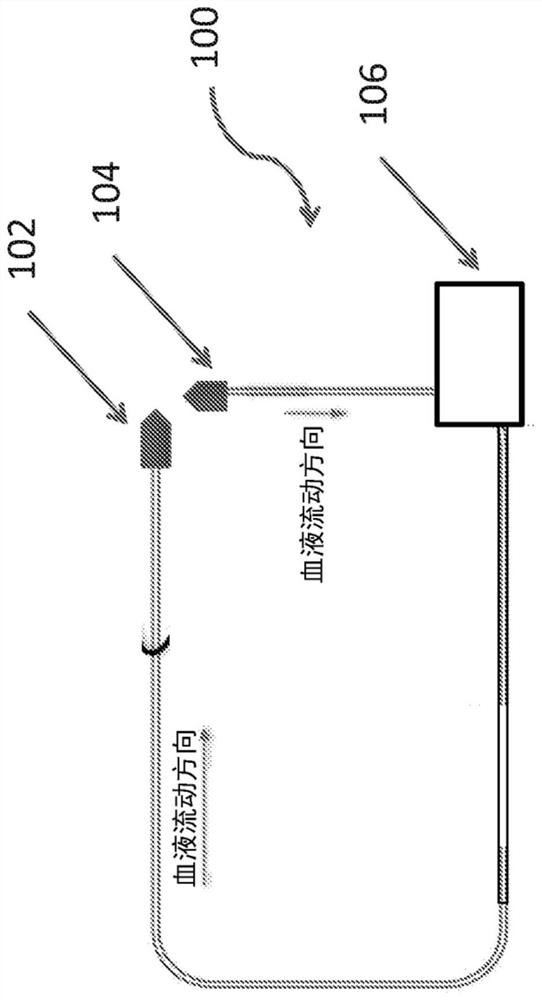 Systems and methods for extracorporeal support