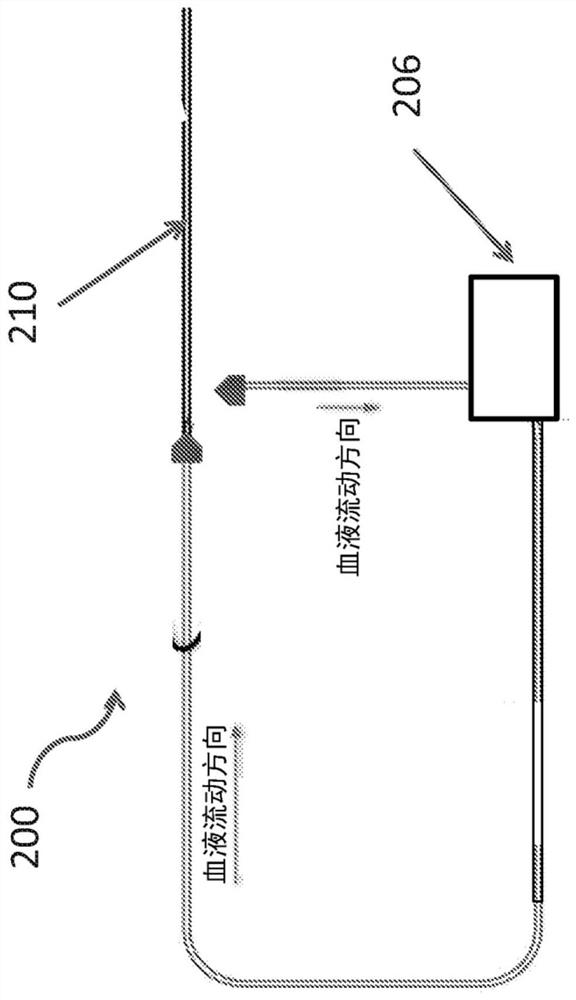 Systems and methods for extracorporeal support