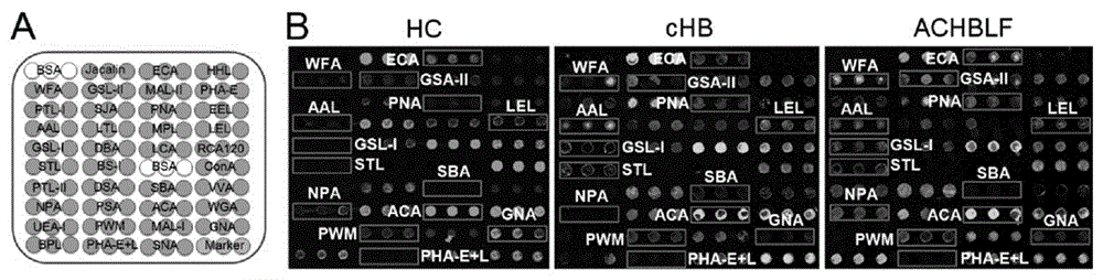 Lectin chip for detecting carbohydrate chain markers based on blood serum and commonly based on protein in blood serum and saliva as well as kit and application of lectin chip