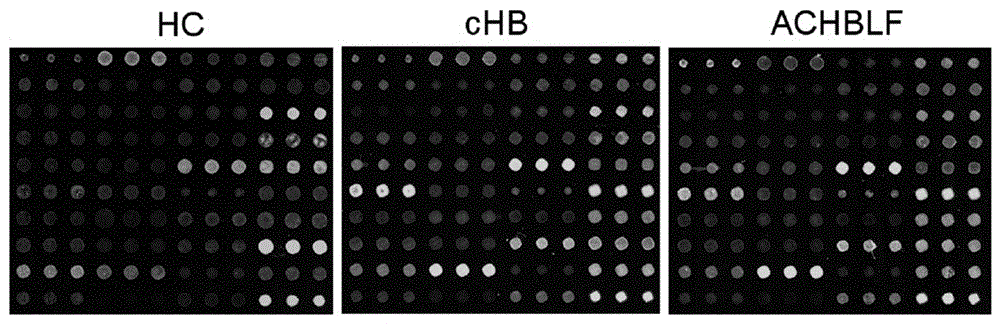 Lectin chip for detecting carbohydrate chain markers based on blood serum and commonly based on protein in blood serum and saliva as well as kit and application of lectin chip