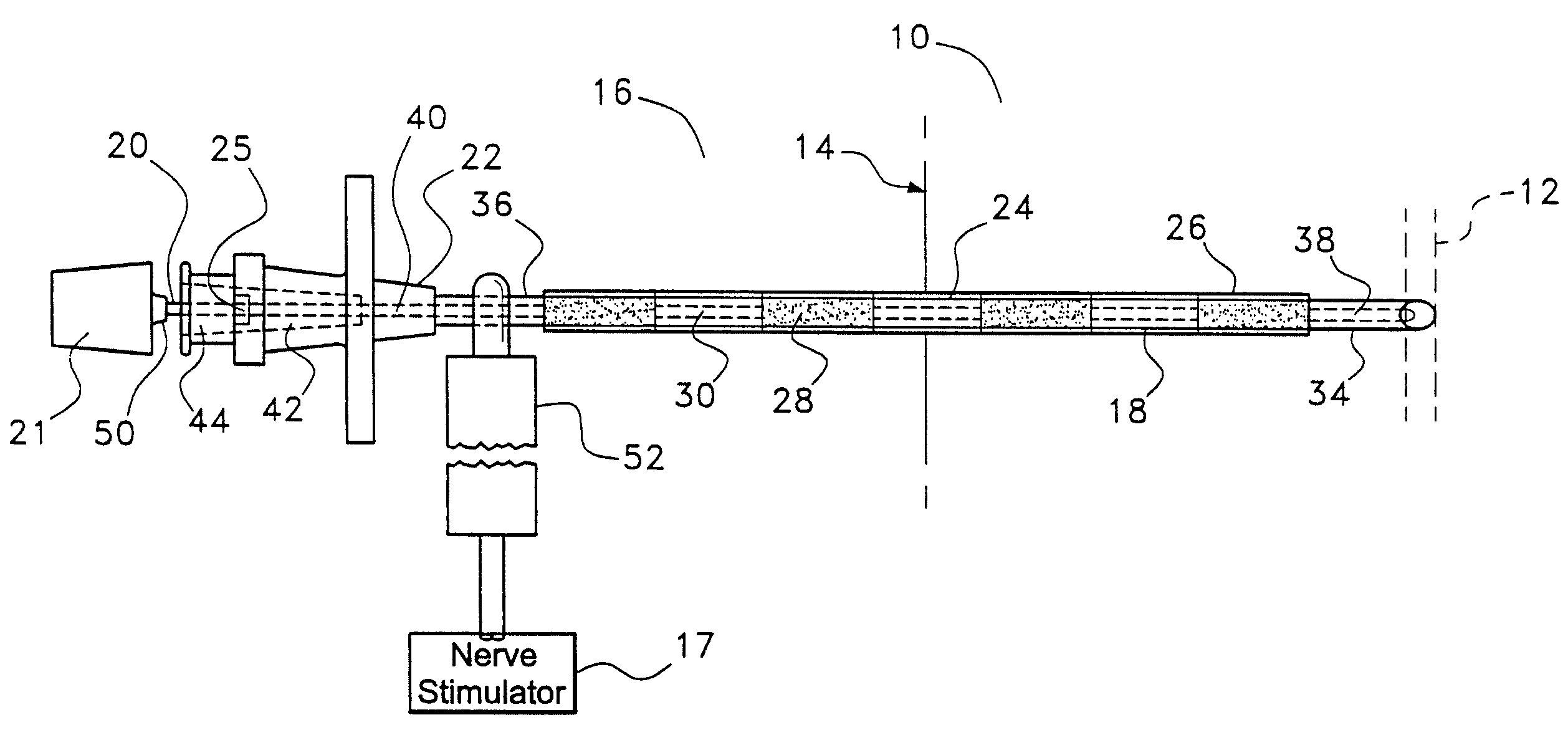 Instrument and method for delivery of anaesthetic drugs