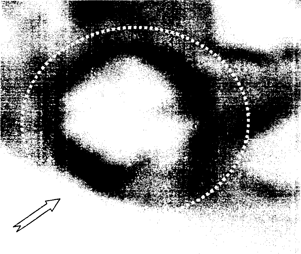 Process for preparing foam composite material of magnesium alloy-pearlite