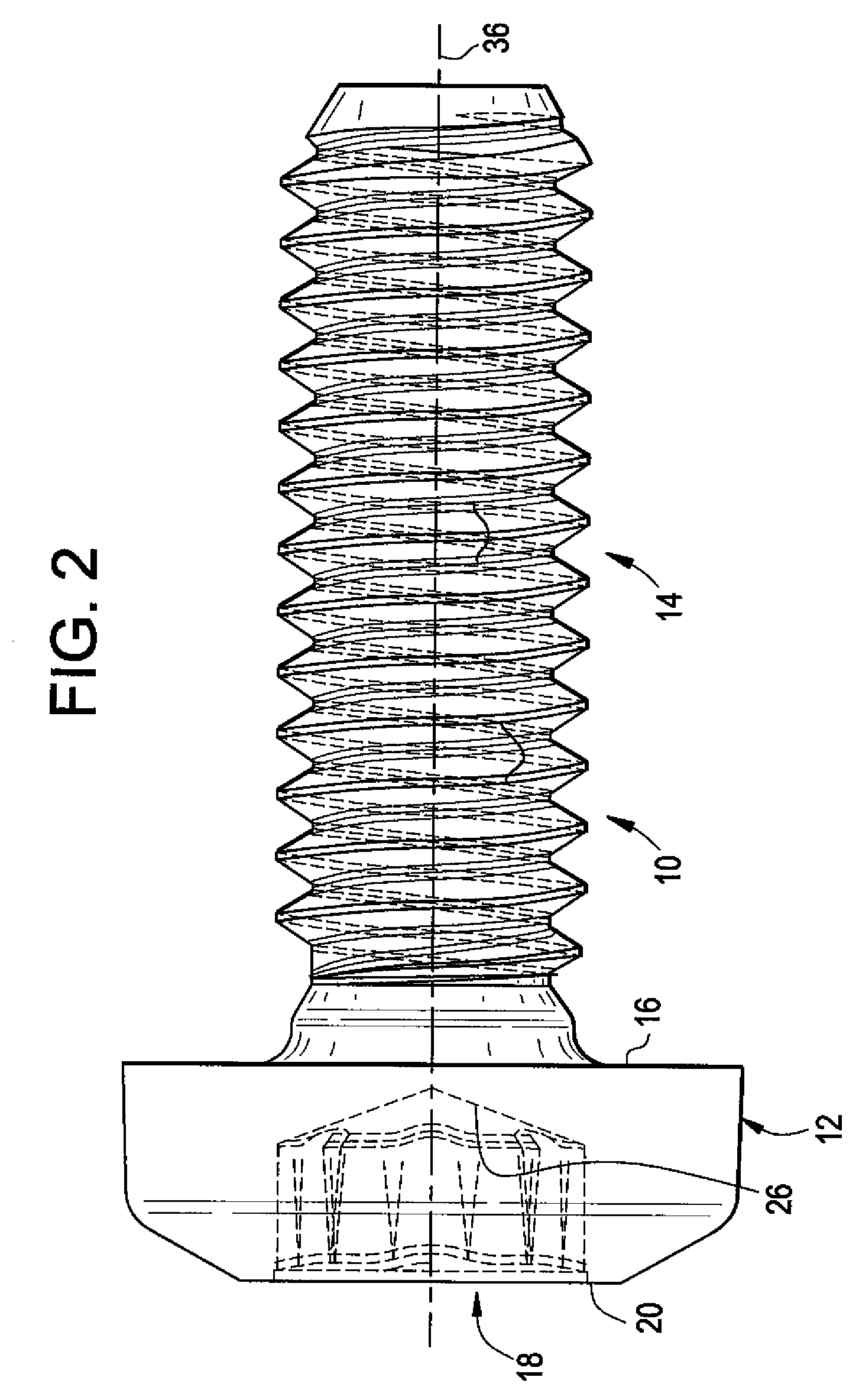 Lobular drive system with interference fit and method and apparatus for fabricating same