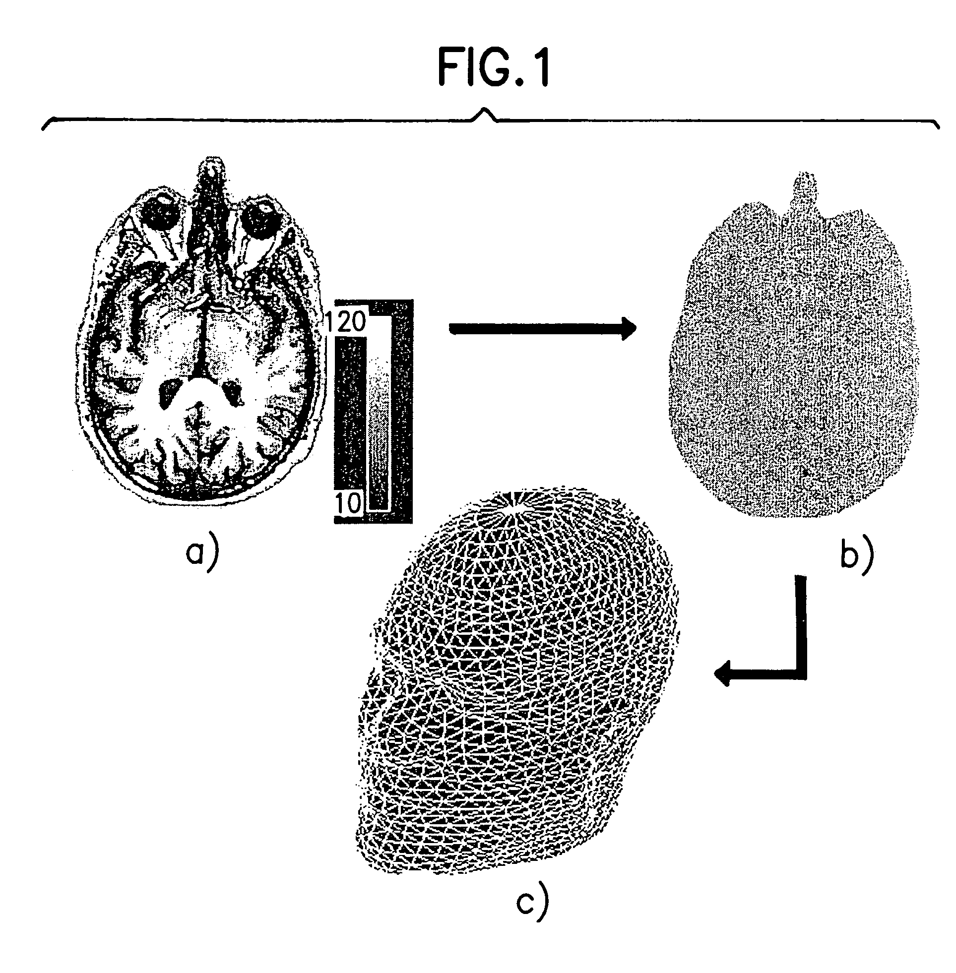 System and method for the tomography of the primary electric current of the brain and of the heart