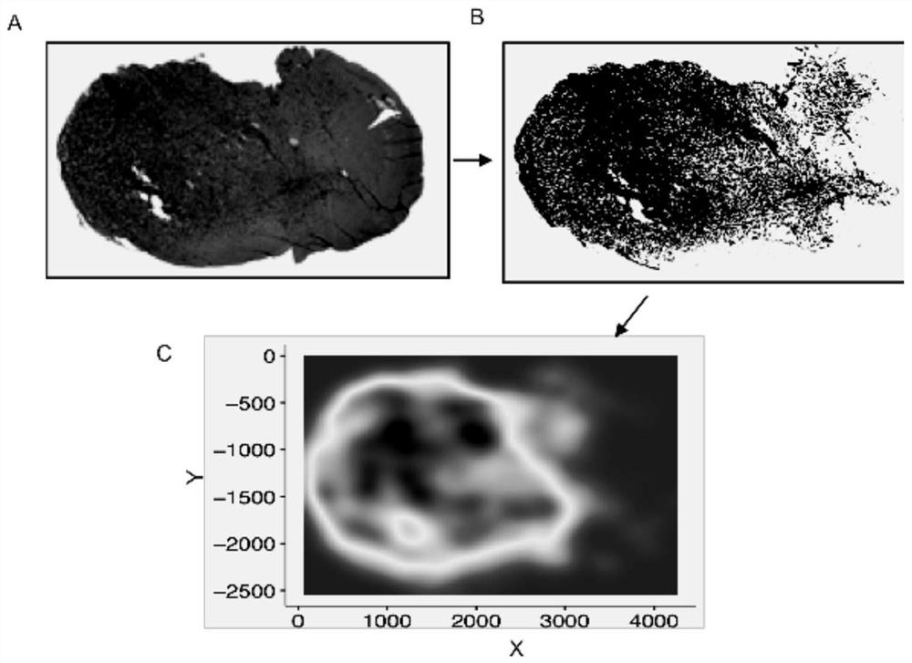 Visualization method for quantifying glioma invasiveness based on kernel density function