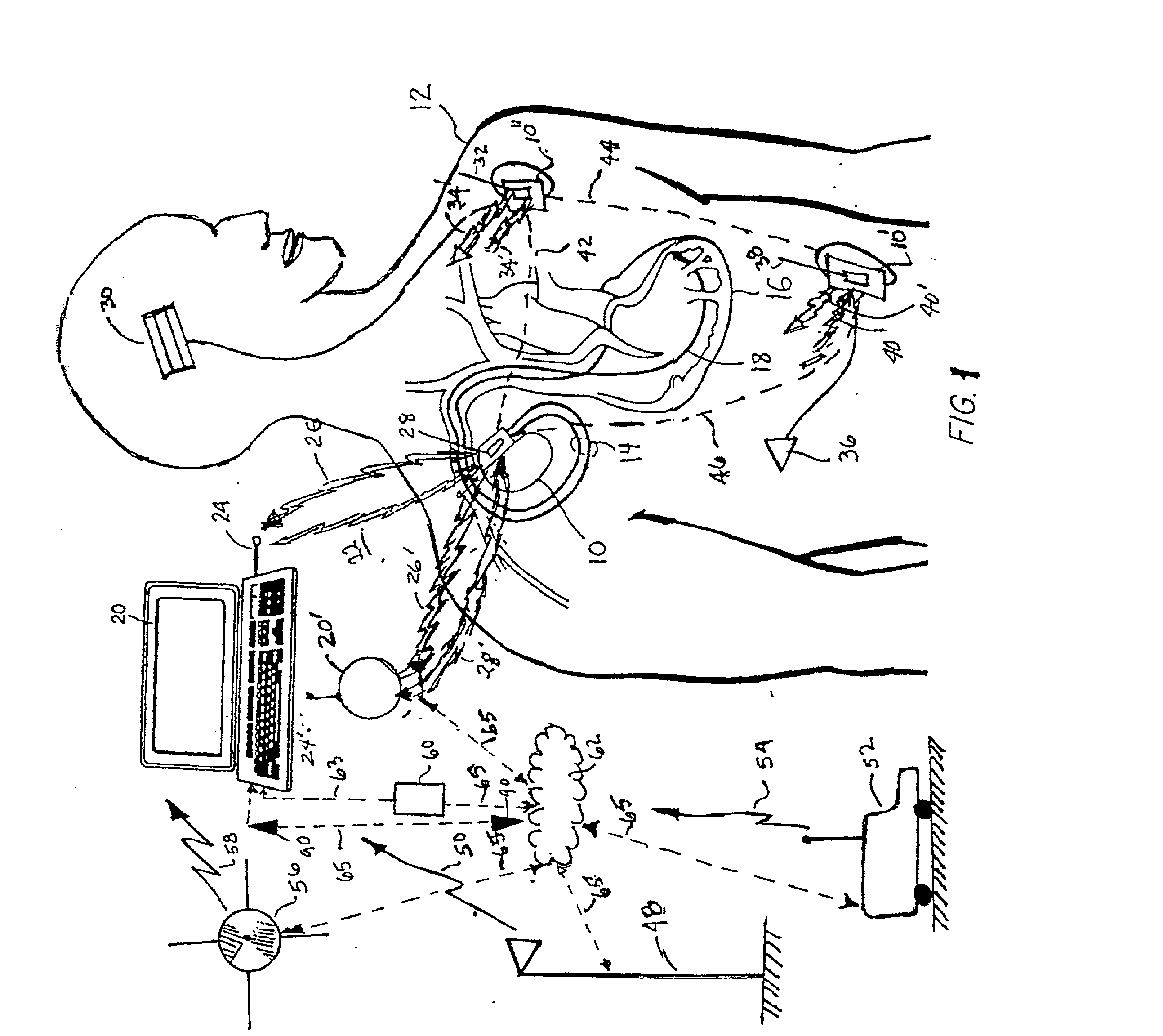 Method and apparatus for remotely programming implantable medical devices