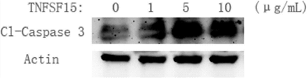 Use of TNFSF15 protein in preparation of melanoma treatment medicine