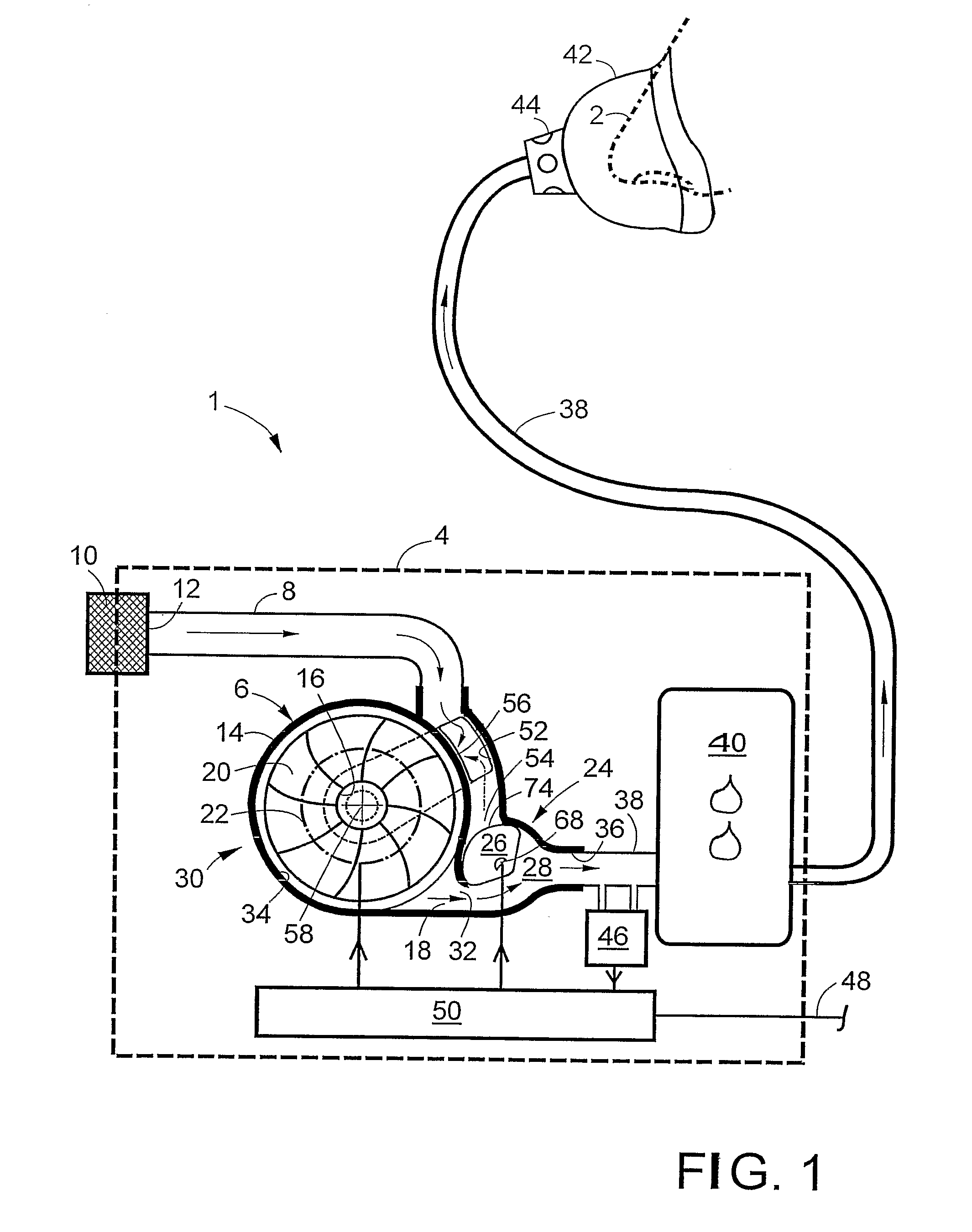 Control Valve for a Ventilator