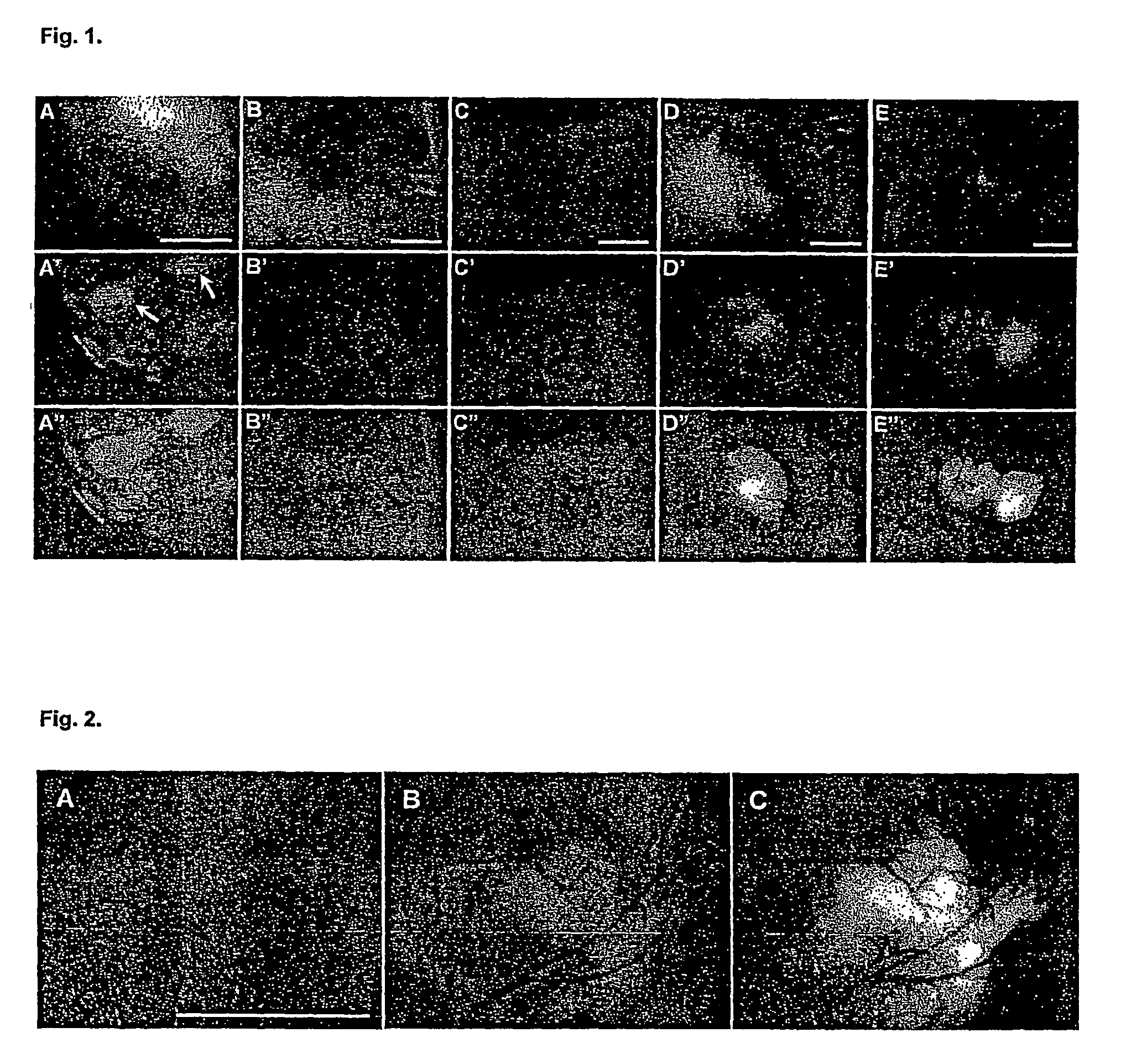 Vaccinia virus for diagnosis and therapy of tumors