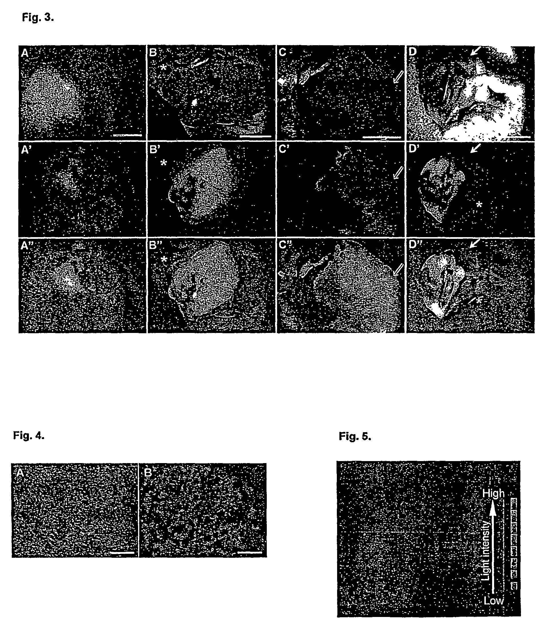 Vaccinia virus for diagnosis and therapy of tumors