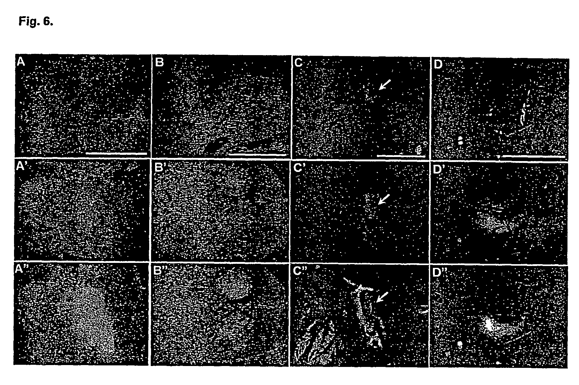 Vaccinia virus for diagnosis and therapy of tumors