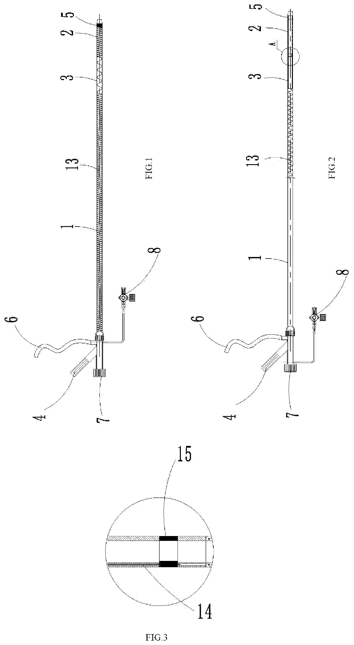 Thrombus treatment platform