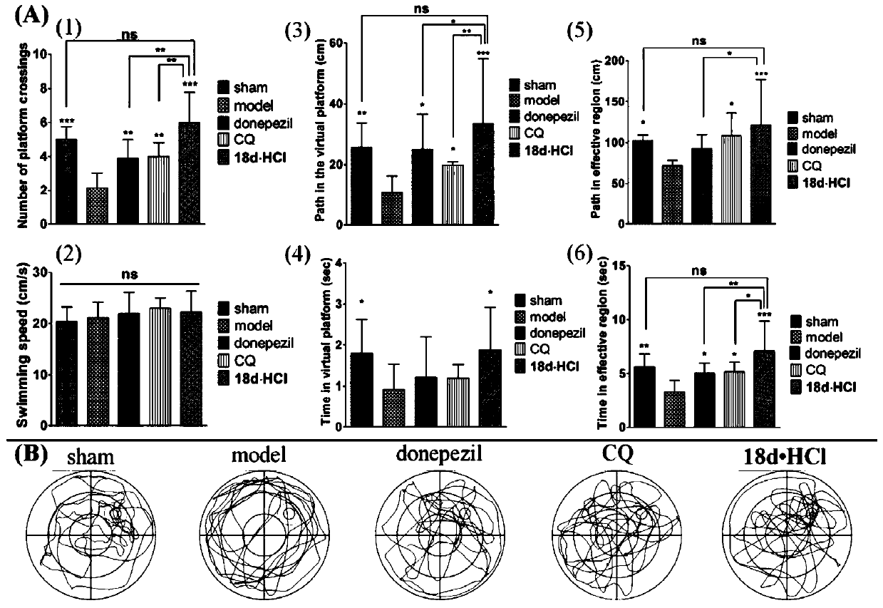 Benzofuran quinoline derivatives and their application in the preparation of medicines for treating Alzheimer's disease